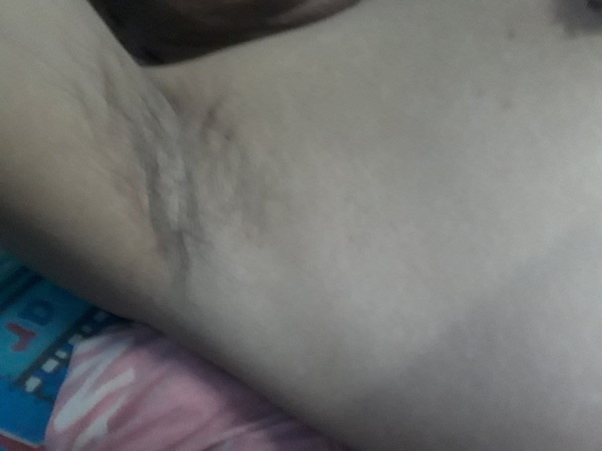 Oldmanarmpit's tweet photo. อบต.คนดัง โชว์รักแร้ ขนนิดๆ แต่เห็นแล้ว น่าเลีย
#Fetisharmpit https://t.co/jtjAfdhBbz