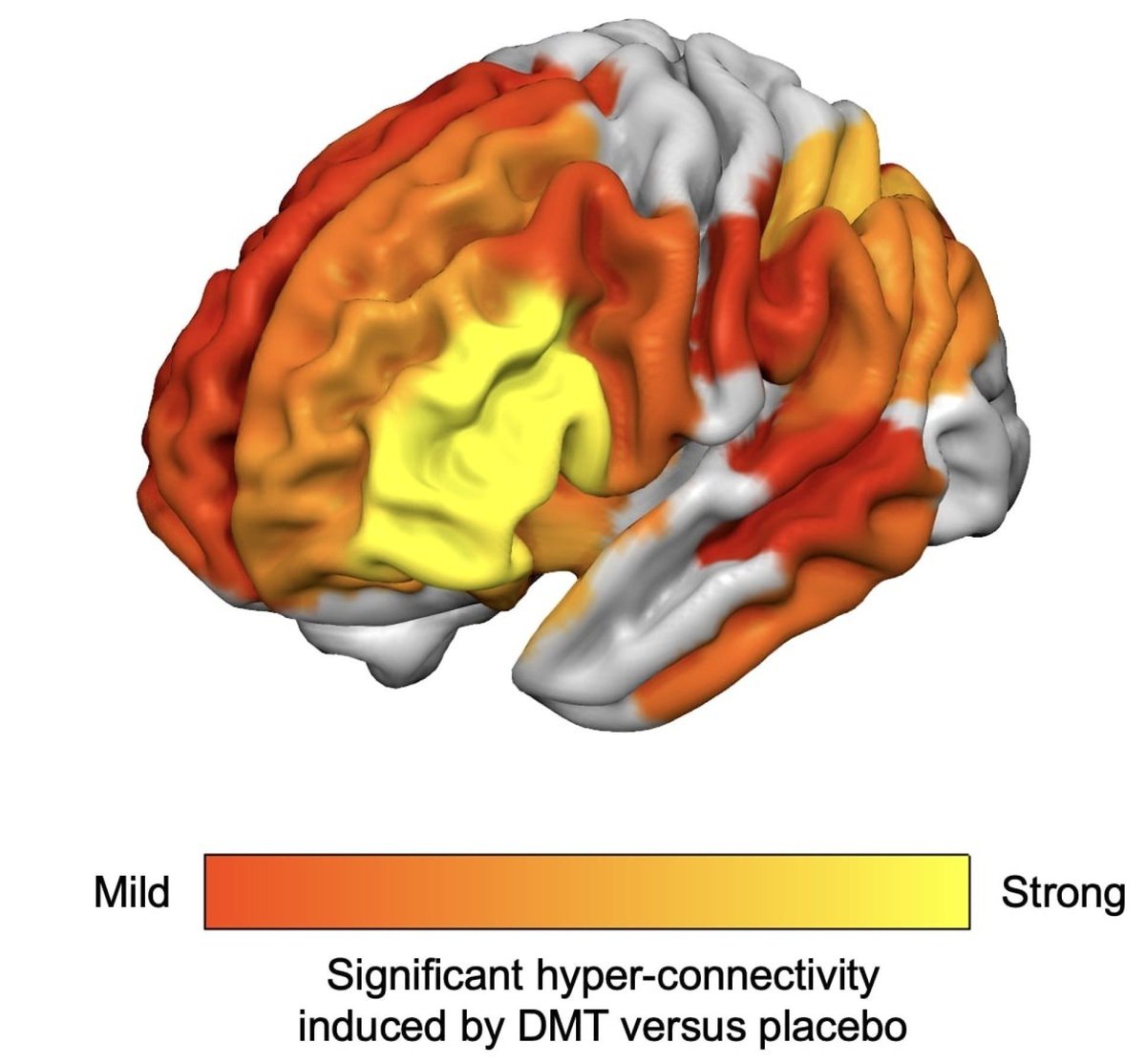 jamessmiths07's tweet photo. DMT is the only drug where the trip report sounds clinically insane and the brain scan looks like meditation on steroids.
#drugtwt
#Psychedelics
#mentalhealth
#lsdtwt https://t.co/zWKOxREAUW