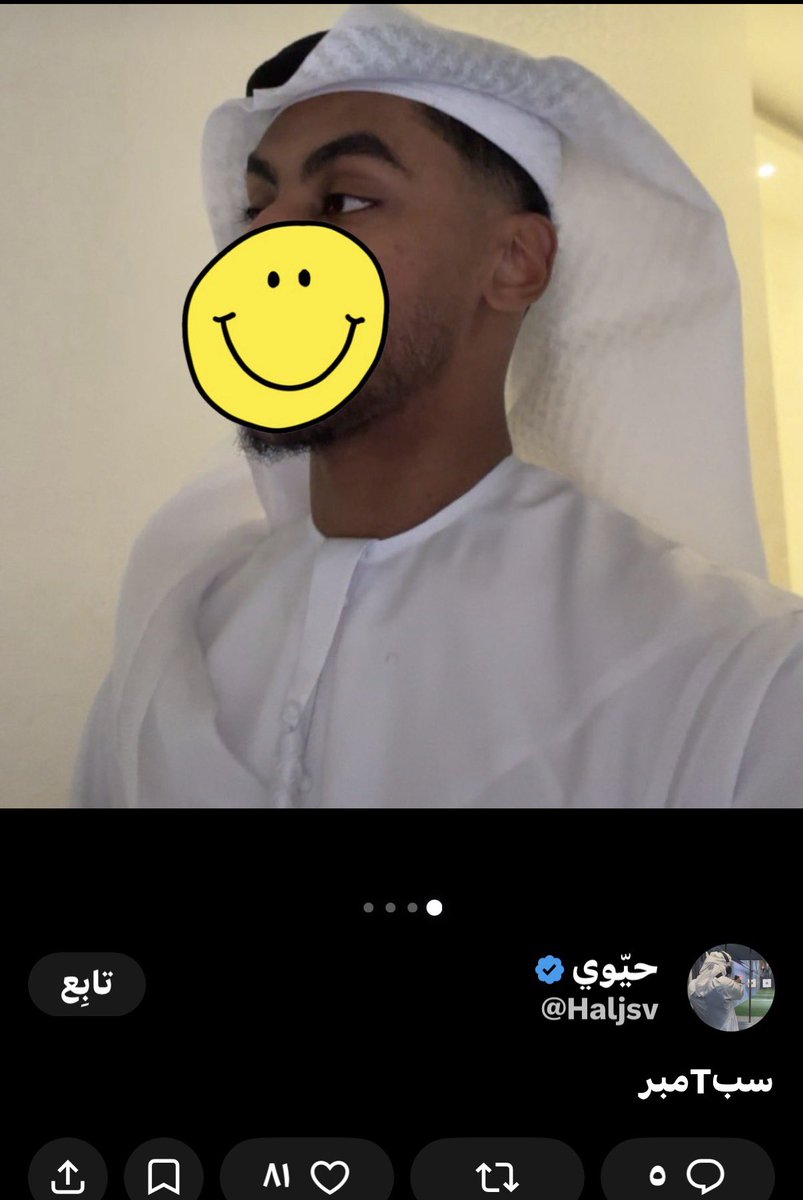 lllove1x's tweet photo. شوفوا من يعيب على لهجتنا ع••بد أفريقي  ماله أصل 🤢
تفووووو على الوجه بس https://t.co/QUGGc1ABHU