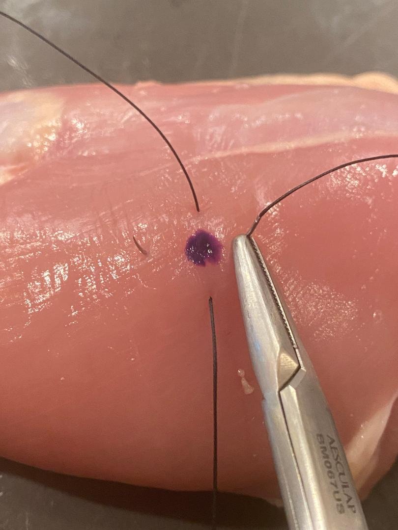 rbarbosa91's tweet photo. 🧵OK, I'm doing a talk next week to a group that won't have any idea why I'm there, so I'm going to repost some of my older 🧵

This one is on the 'figure-of eight' and also the 'pursestring' sutures. 

We'll go over what they're for and some technical pointers and pitfalls. https://t.co/19YzAusZUj
