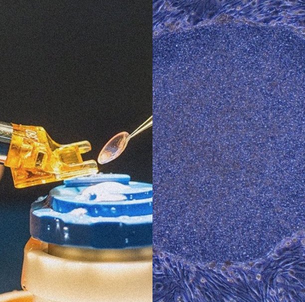 DARKCOMX's tweet photo. Japan has approved the world’s first iPS cell-based therapies, using reprogrammed cells to create heart muscle and neural cells for severe heart failure and Parkinson’s disease. The shift is from using medicine to manage damaged tissue toward replacing some of the cells that were lost. But both therapies received conditional, time-limited approval, with further evidence still required.

Japan Moves Stem Cells Into Treatment