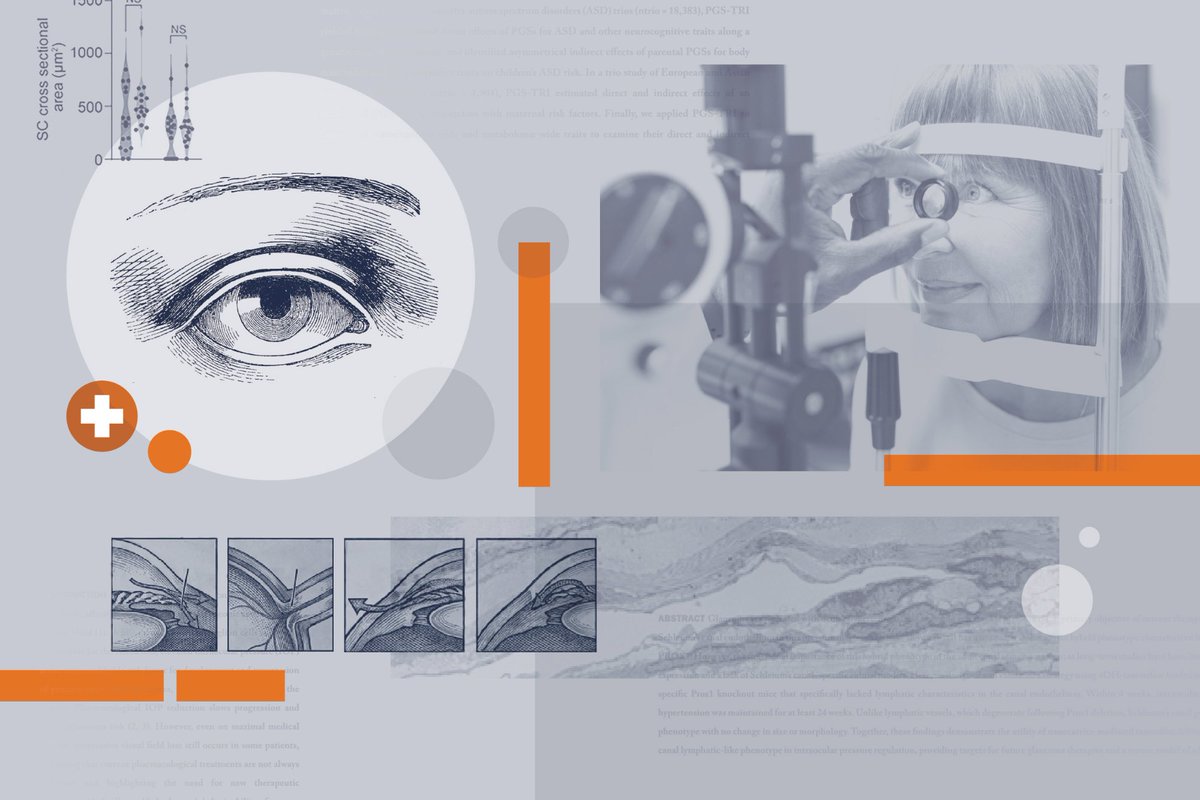BiomatNet's tweet photo. News
Q&A: Could this discovery lead to a cure for glaucoma?
https://t.co/Mx4sIZgqGU
#news #science
#biodegradability #bioengineering #biomaterials #biomedical #biotechnology #cells #drugdelivery #glaucoma #nanomaterials #nanotherapy #ophtalmology #polymers #tissueengineering https://t.co/XqSj4sDuEJ