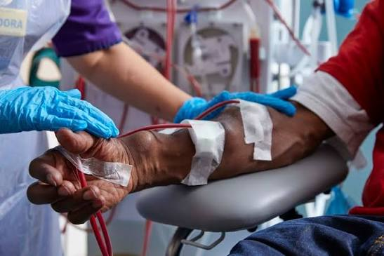 A medical worker in blue gloves measures blood pressure on a patient's arm using a cuff, unaware that the arm contains a vascular access shunt (used for dialysis), as cautioned in the caption about checking for shunts before taking blood pressure readings.