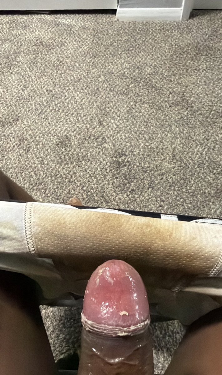 Oscar_Ramsex01's tweet photo. SMEGMA DÍA 3 - > @you_sexyboy 🔥🥵
#チンカス #schwanzkäse #smegma #smellycock #dirtycock #dirtydick #pausujo #cheirodepica #sebo #dirtydick #cheeseeating #pigplay #smellydick #smellycock #包皮垢 https://t.co/eBEeW0sP0B