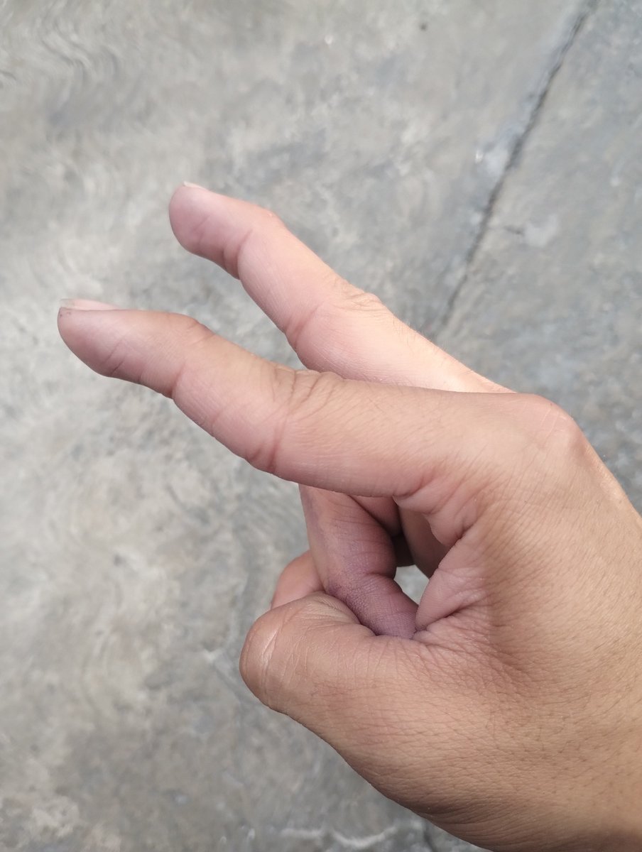ZackAlt_2005's tweet photo. @RukiAlfa_ Entonces supongo que yo también soy así? Siempre he podido poner  todos mis dedos así(solo de las manos) como lo muestras en la imagen ☝️ https://t.co/d3YFbMg21S