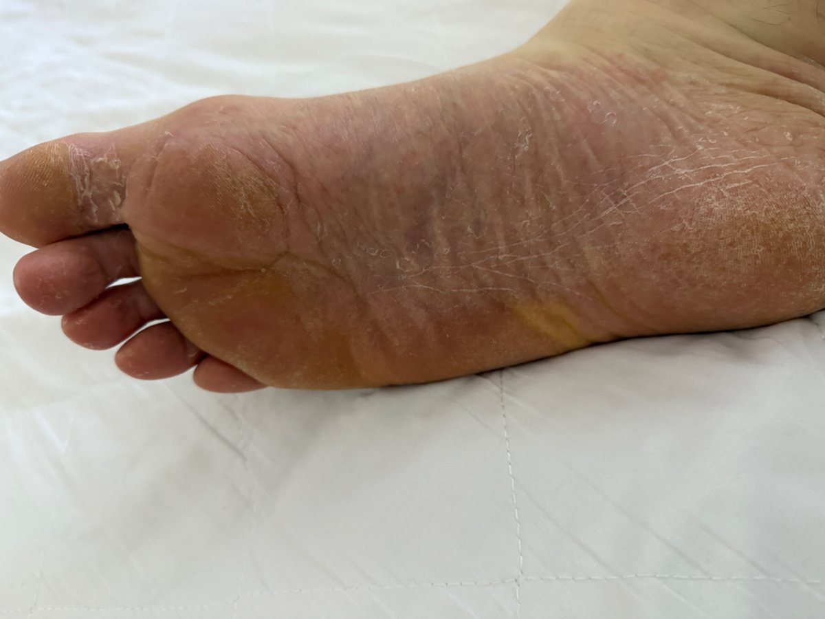Real_NoFilter's tweet photo. Horny Sunday morning…. I want you to cum on my dry stinking rough soles https://t.co/75YIsOcd7F