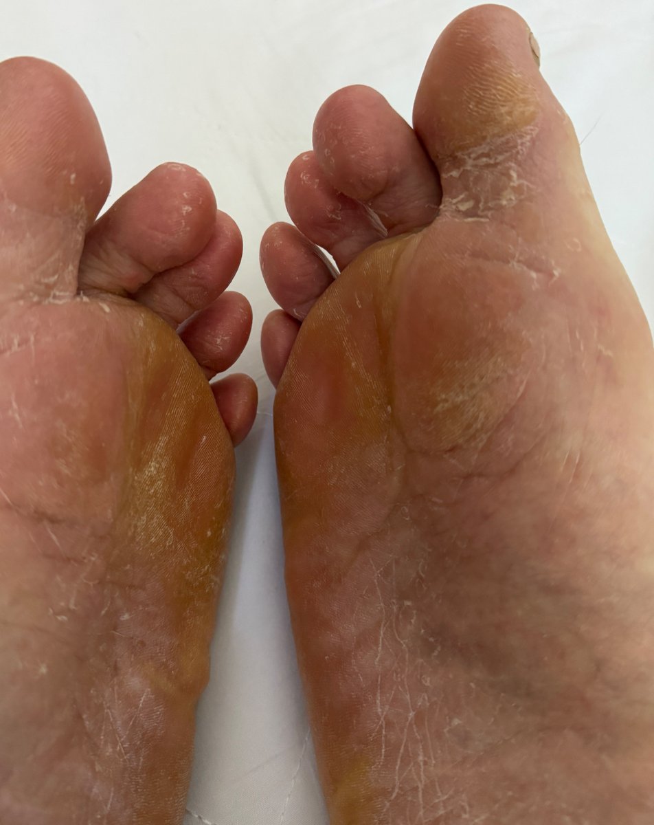 Real_NoFilter's tweet photo. Horny Sunday morning…. I want you to cum on my dry stinking rough soles https://t.co/75YIsOcd7F