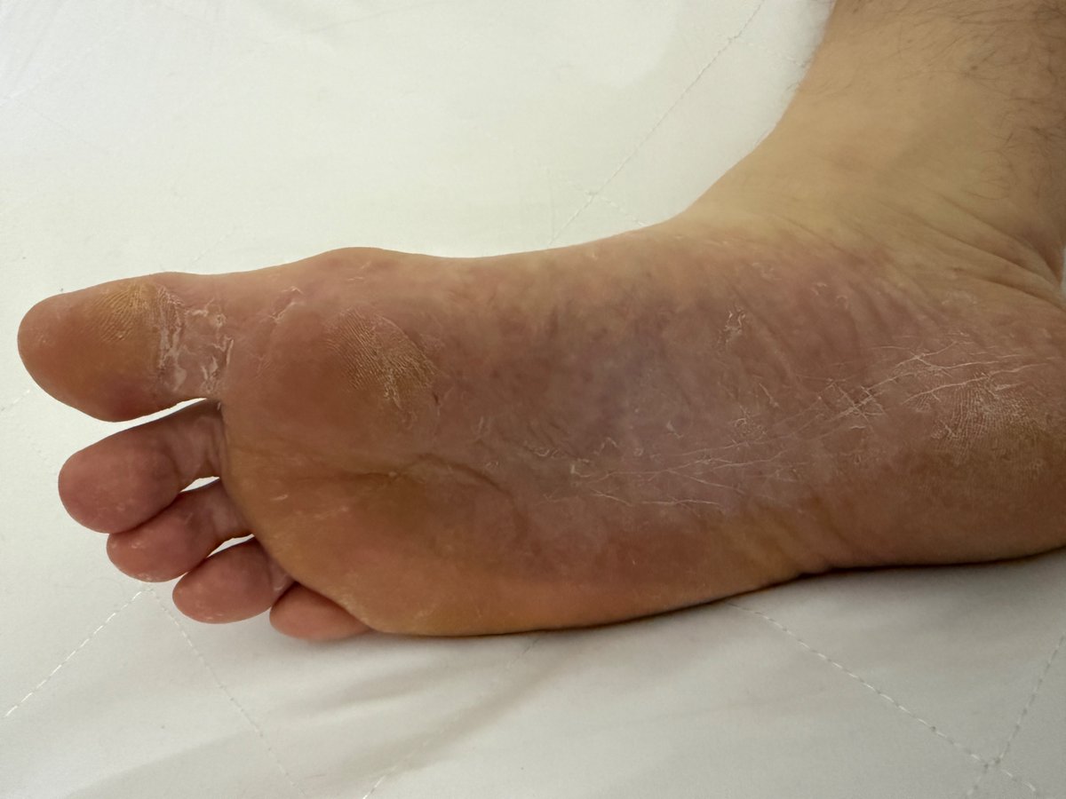 Real_NoFilter's tweet photo. Horny Sunday morning…. I want you to cum on my dry stinking rough soles https://t.co/75YIsOcd7F
