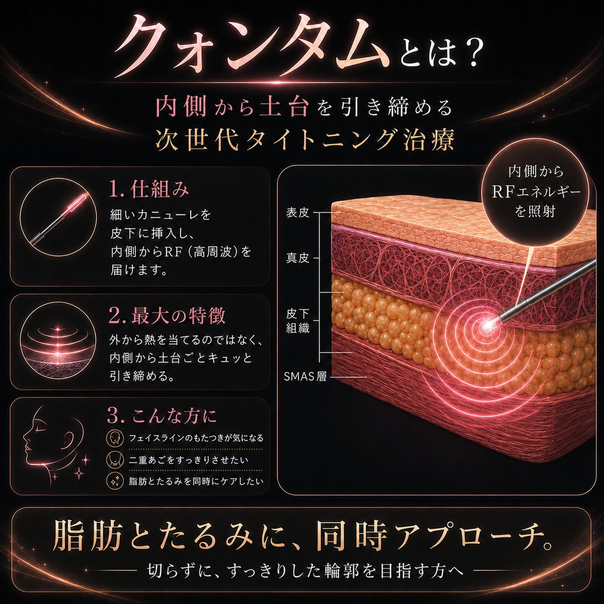 theclinic_abe's tweet photo. ✨️緊急企画✨️
Xでクォンタムが話題になってます！
クォンタムを体験したいフォロワーさんへ

お顔のクォンタムを1名の方に施術します。
今回モニターに選ばれた方は施術費用無料です。
ご希望の方はDMでご応募ください。
締切は10/9です。
ご連絡は当選された方のみにお送りします🙇

※効果には個人差があります。
カウンセリングで適応外の場合はご案内できない場合があります。

主なリスク：腫れ・内出血・色素沈着など
（詳細はカウンセリング時に説明いたします）