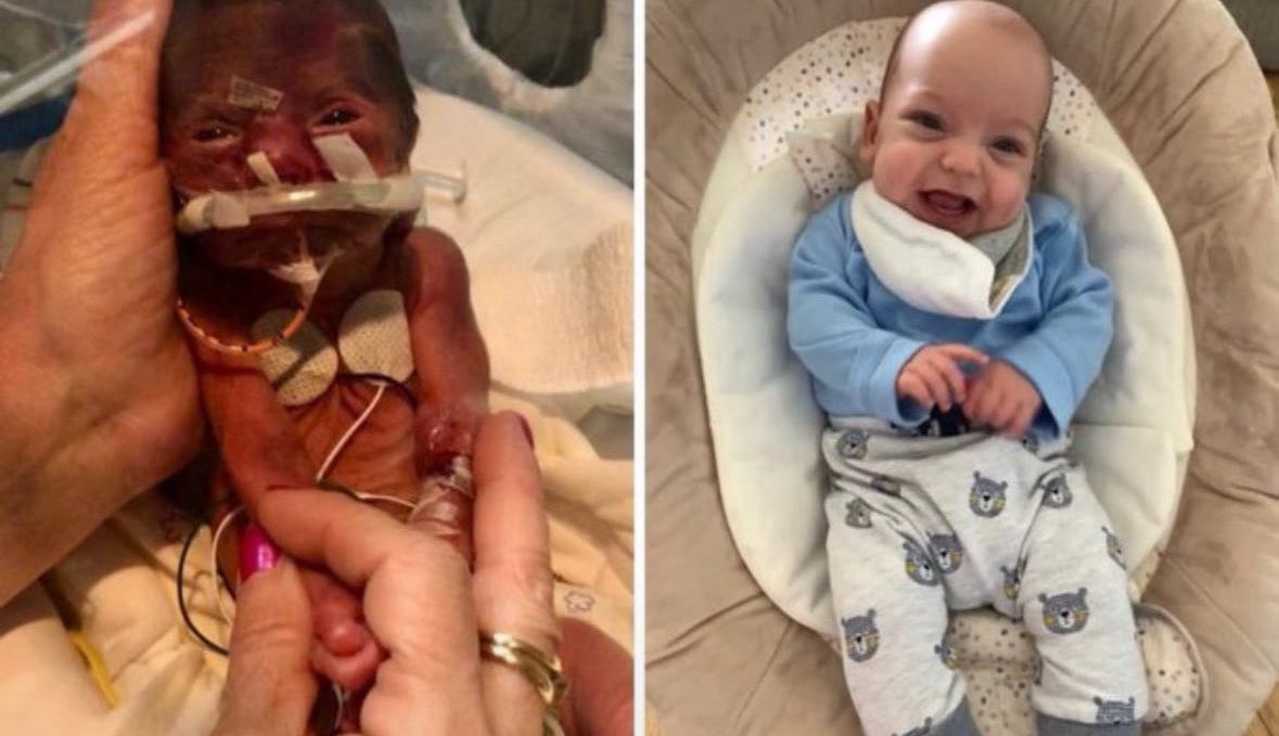 annamlulis's tweet photo. Meet Alfie.

He was born premature at 26 weeks.

He is not a “clump of cells”

He is a human being worthy of life. https://t.co/KmuT6i1KB1