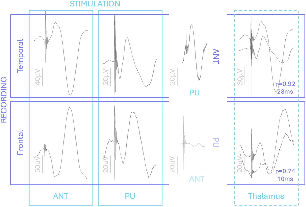 ClinicalNeuroph's tweet photo. [Thalamo-thalamic evoked potential] Feys et al.: "Intra-thalamic connectivity shapes thalamo-cortical evoked potentials in the human brain." https://t.co/iMXPCD2WuP https://t.co/xUx0XEvczo