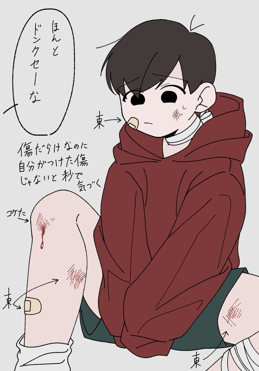 capetto0811's tweet photo. 尚、殆ど東さんがつけた傷
おそが２０歳くらいになったら
どれがどの傷でしょうかクイズする
東おそ https://t.co/P21LWbWogE