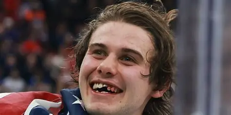 Wildpucks's tweet photo. @puckempire Comments in this thread calling Jack soft must be the elbows up crowd.  Remember when this guy slept an entire nation? https://t.co/T5i0QgA2Jw