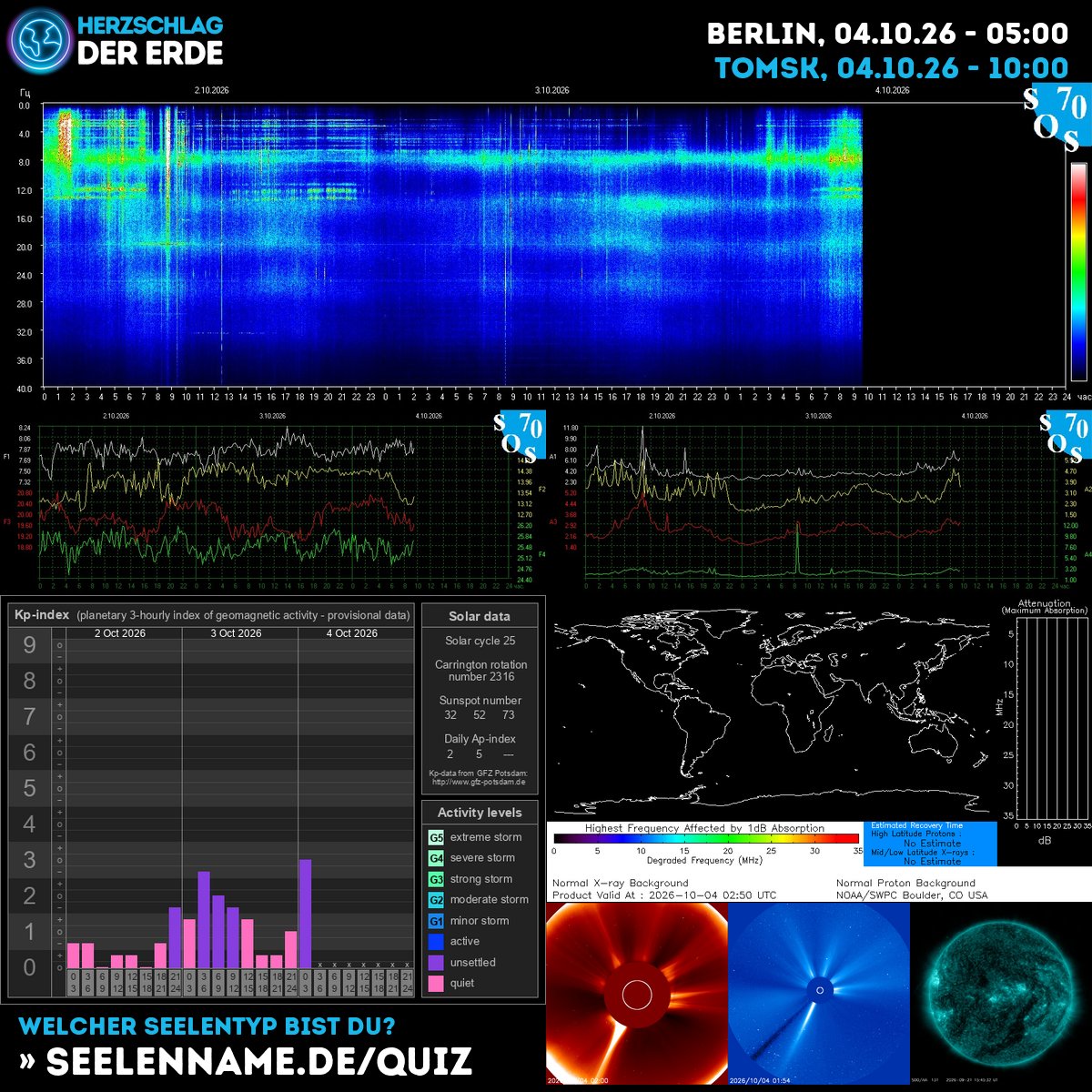 SchumannBotDE's tweet photo. 🌍✨ Today's cosmic pulse is strong &amp; alive! The Earth's heartbeat carries powerful solar whispers—tune in &amp; let the universe guide your path. 💫 #CosmicEnergy #Schumann #SolarWisdom https://t.co/fEMtt6DdjI https://t.co/vxn90afsfb