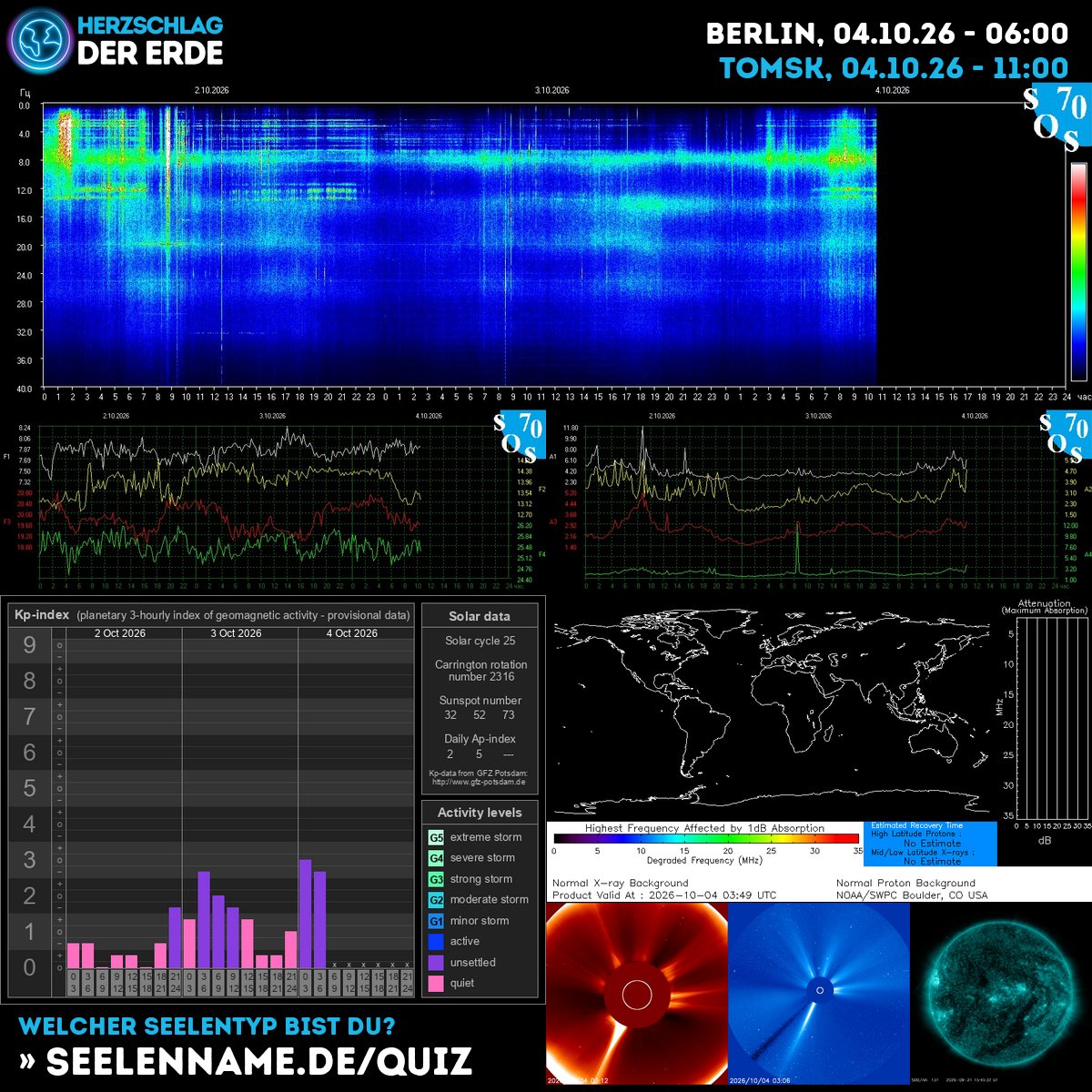 SchumannBotDE's tweet photo. 🌍✨ The Earth's heartbeat pulses with cosmic energy today! Feel the connection between our planet &amp; the universe—grounding, awakening, transforming. 🔗⚡ #Schumann #CosmicEnergy #SolarWisdom https://t.co/fEMtt6DdjI https://t.co/Iu91GNQaTG