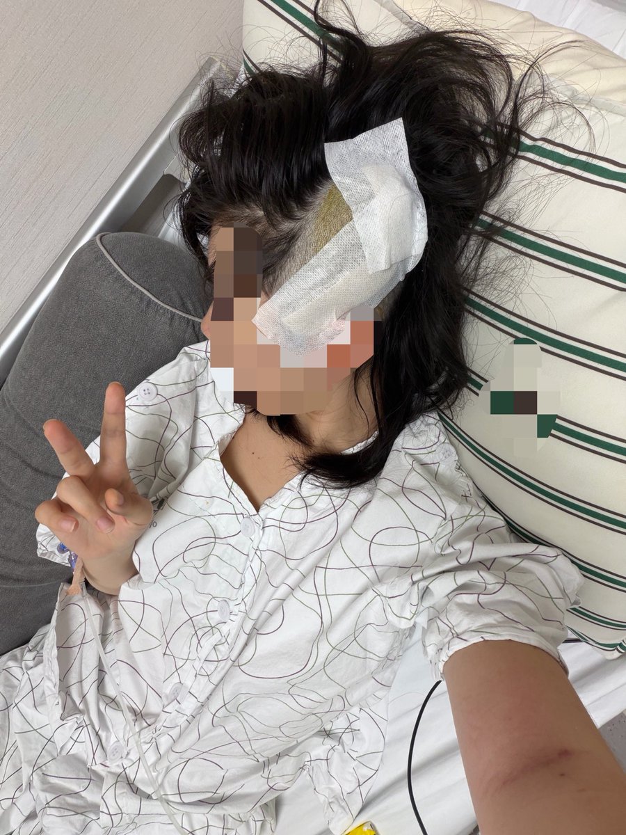 aesoon2ni's tweet photo. 근황: 머리털이 emo kid가 되었고요 다음주까지 머리감기 금지당했습니다(ㅅㅂ) 주삿바늘로 찔리기 82401회, 앞자리 할머니의 아들이름 울부짖음에 놀라서 깨기 3748189회를 당하고 다른 병원으로 가요🥹늦어도 돌아오는 주 안에는 퇴원 가능하다고 하네요...~ 걱정해쥬셔서 넘넘감사드려요 https://t.co/4Oemz9hi1z
