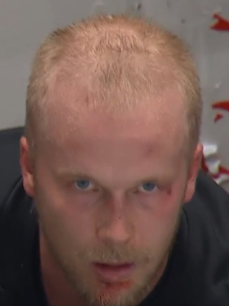 AndehWahl's tweet photo. Dude has a black eye, broken stitches on his chin and some Forsberg-looking eyes. Look out #Canucks https://t.co/PlKyxCuIy3