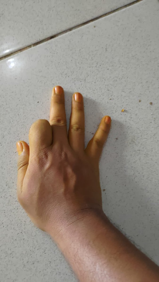 stardustopname's tweet photo. Kunyit + kuku? 
Katanya bikin kuku jadi bagus pakai kunyit. 
Oke, saya coba. 
Hasilnya? Memang amazing! 
Tapi ada satu masalah... 
Parah sih, ngilanginnya susah banget!  
Tapi ya sudahlah, namanya juga eksperimen. 
Ini amazing untuk saya. 
Coba, amazing versi kamu apa? https://t.co/9QMsADFhdZ