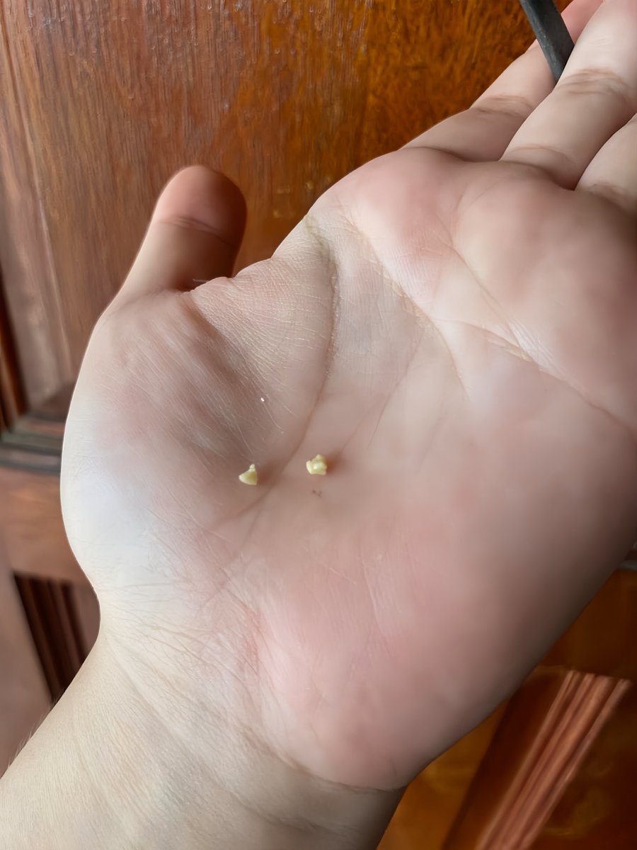 xbananah's tweet photo. GILA BAUNYA BENERAN SE-NYENGAT INI 😭
thanks to mbak mbak yang udah spill hacks ini, aku coba ternyata beneran ngaruh dongg. sekarang napas jadi jauh lebih fresh https://t.co/nqUw2Z6e29