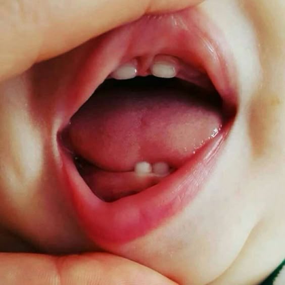 SabzerAzoh's tweet photo. The teething stage of a Black African baby is not merely a biological development; it is a critical, trans-dimensional transit window. When a child begins to cut teeth, they are transitioning from the fluid, water-based world of the ancestors into the dense, material reality of the earth. At this exact junction, the baby’s physical and spiritual immunity drops, while the soft boundaries of their developing auric field become highly vulnerable.

The physical symptoms of teething, the fevers, restless crying, and chronic, unexplained illnesses, are often the physical feedback loops of a trans-dimensional struggle. Countless disembodied spirits, entity streams, and low-frequency phantoms are actively seeking to anchor themselves into living human vessels, and a teething infant becomes a particularly vulnerable target for energetic hijacking.

The traditional deployment of a protective necklace containing a horse tooth, a wild pig or warthog tooth, and a monkey nail is an advanced form of organic, bio-electric encryption. These items are not merely teething objects; they are frequency anchors.

The horse is an animal of unparalleled endurance, swift movement, and spatial awareness. Its teeth hold a high-calcium, highly mineralized structural frequency associated with rapid adaptation. When placed around the baby’s neck, the horse tooth acts as an internal tuning fork, stabilizing the baby’s erratic nervous system during fevers and creating an aggressive boundary wall against stray entity attachments.

The wild pig or warthog is a master survivor that digs deep into the roots of the earth and endures many of the harsh elements of the bush. Its tusk carries a dense, fierce Root Chakra frequency of absolute grounding. It creates an energetic weight that anchors the baby’s descending spirit firmly into their own bones, ensuring that no outside entity can push the child’s consciousness out of their body.

The monkey is an entity of swift agility, high-vibrational curiosity, and sharp reflexes. Its nails carry the energetic signature of gripping and tearing. Esoterically, the monkey nail acts as an olfactory and psychic hook. If a negative entity attempts to reach into the baby’s auric space, the frequency of the nail literally rips through the incoming wave stream, deflecting the psychic attack before it can settle into the infant’s soft skin.

The universe is densely populated by wandering conscious entities that lack physical forms but desperately crave the physical experience of life. They want to taste, feel, and operate within the material world. Because a baby’s spirit is still forming its protective skin, these entities seek moments of physical stress, such as the inflammation associated with teething, to slip past the child’s guard.

When a baby experiences unexplained, on-and-off illnesses that baffle modern clinics, it may be understood within this traditional framework as the biological system fighting off an unauthorised spiritual tenant. If the protection is not installed, the entity can partially attach itself, subtly altering the child’s natural personality, locking down their third eye, and hijacking their cosmic destiny before they even reach adulthood.🍃🫶🏽