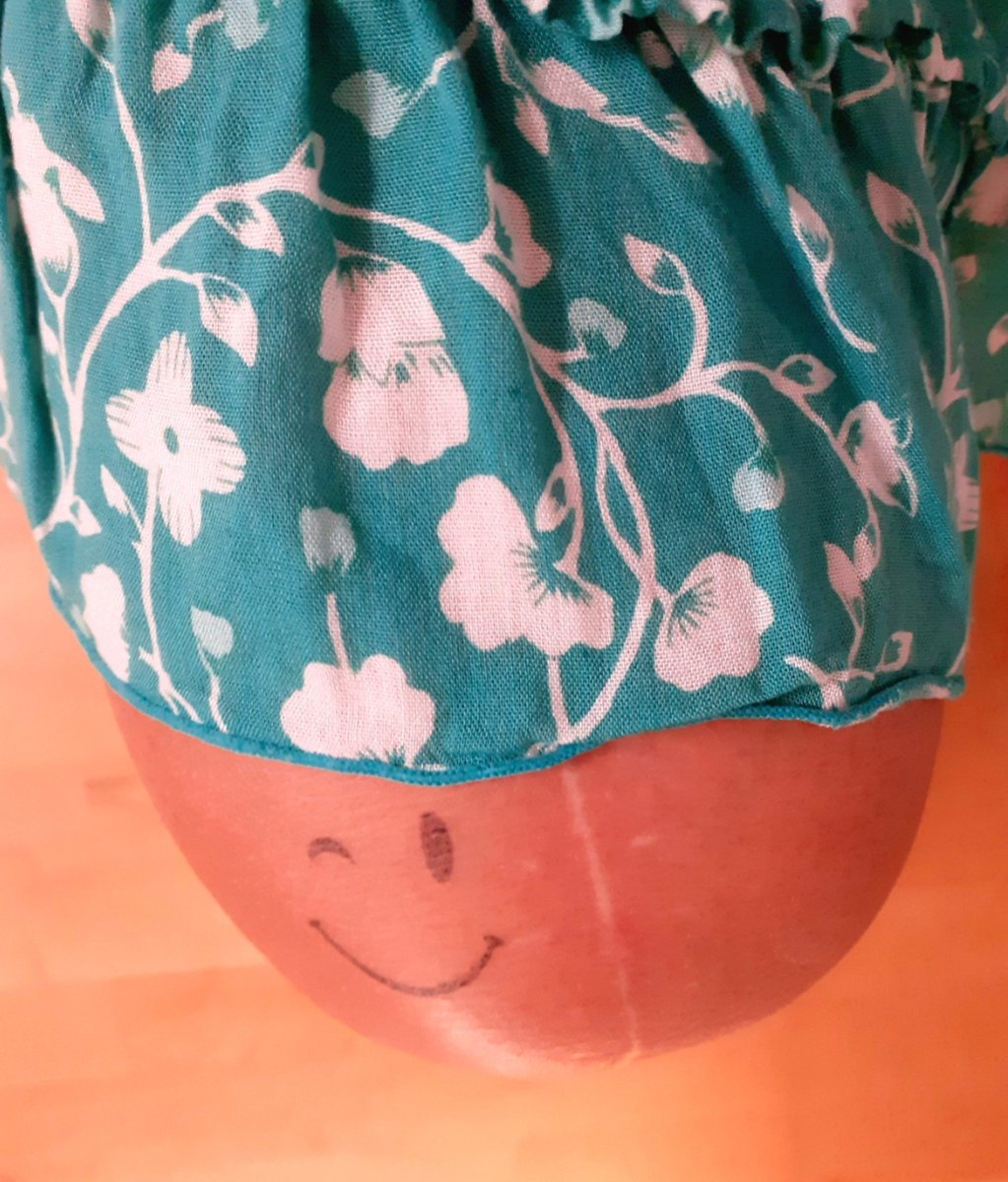 eurisko7's tweet photo. @Sofaloewe Tut mir leid, dass dein Knie Probleme macht. Inzwischen hatte ich 2 X eine RSO und schon nach der 1. ging es mir viel besser. Ich bin sehr zufrieden. https://t.co/7kj3fyAWJb