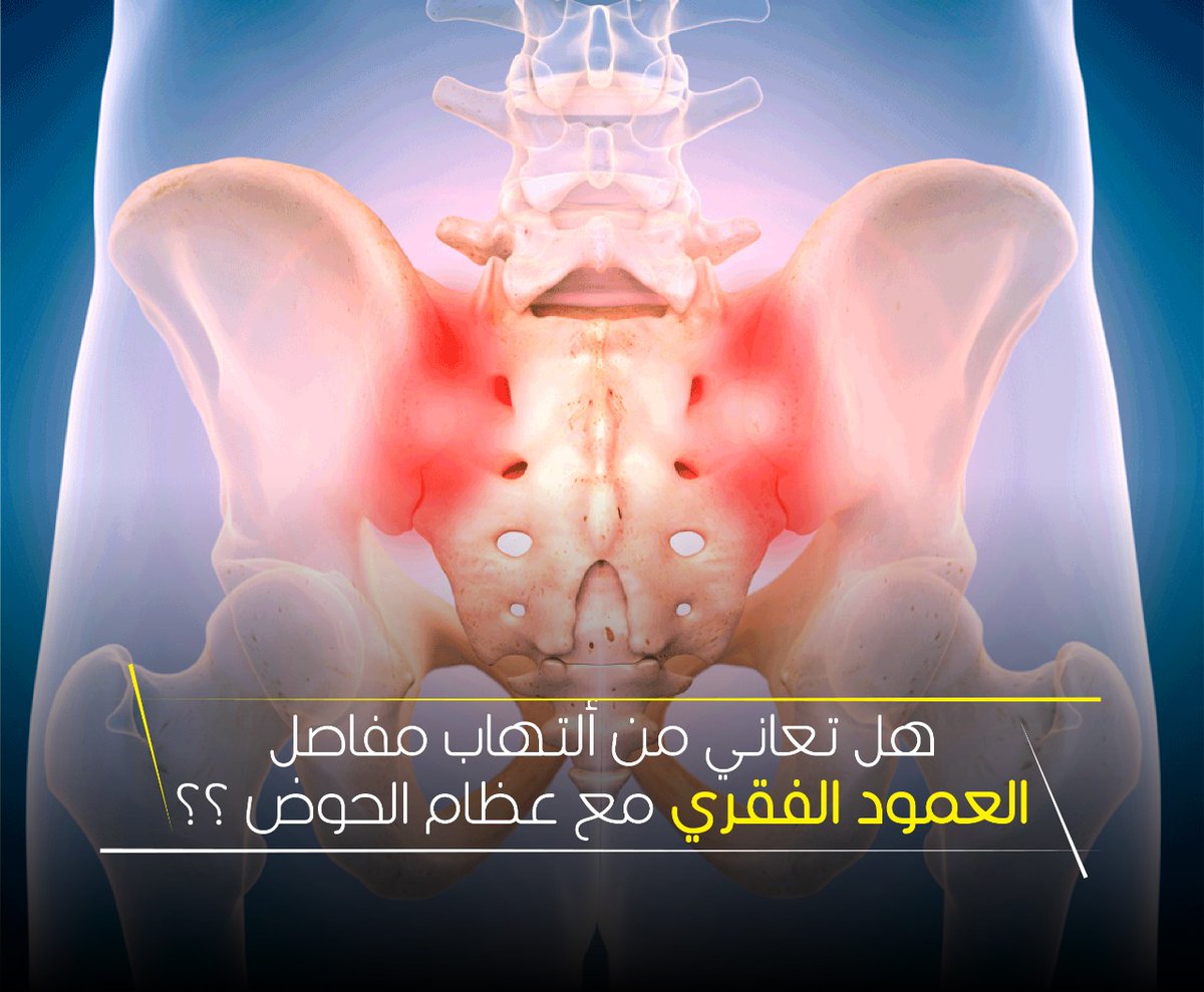 basemhenri's tweet photo. 🦴 إزاي تعرف إنك مصاب بخشونة مفصل الحوض مع المفصل العجزي الحرقفي؟

لو بتعاني من واحد أو أكتر من الأعراض دي، ممكن يكون السبب خشونة أو التهاب في المفصل العجزي الحرقفي (Sacroiliac Joint):

🔹 ألم أسفل الظهر من ناحية واحدة أو الناحيتين.
🔹 ألم في الأرداف أو أعلى الفخذ.
🔹 زيادة الألم عند الوقوف أو المشي لفترة طويلة.
🔹 صعوبة عند القيام من الجلوس أو عند تغيير وضع الجسم.
🔹 ألم عند صعود السلم أو الوقوف على قدم واحدة.
🔹 تيبس في أسفل الظهر خاصة بعد الراحة أو عند الاستيقاظ.
🔹 أحيانًا يمتد الألم إلى الفخذ، لكنه غالبًا لا يصل إلى القدم مثل ألم عرق النسا.
⚠️ لا تهمل هذه الأعراض، لأنها قد تتشابه مع الانزلاق الغضروفي أو عرق النسا، لكن السبب الحقيقي قد يكون المفصل العجزي الحرقفي، ويحتاج إلى تشخيص دقيق لتحديد العلاج المناسب.
💙 التشخيص المبكر يساعد على اختيار العلاج المناسب وتقليل الألم واستعادة الحركة دون تأخير.