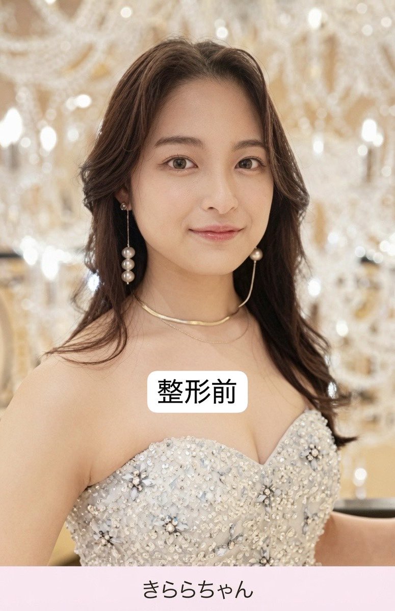 hmweum's tweet photo. 【悲報】きららさん、整形垢時代の画像が発見され、鼻整形のレシピが確定する

鼻整形で鼻柱矯正（鼻中隔延長）、鼻尖縮小（団子鼻修正）、シリコンプロテーゼ挿入と鼻フルカスタムの内容であったことが判明。

整形により単価を上げて港区NO.1貢がれクイーンとなった。 https://t.co/dj3ipnfmg0