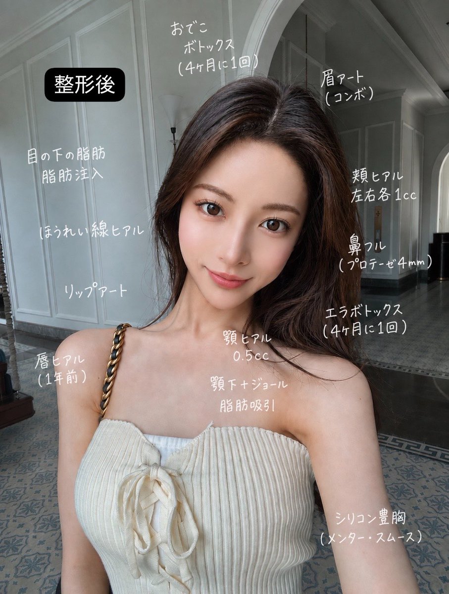 hmweum's tweet photo. 【悲報】きららさん、整形垢時代の画像が発見され、鼻整形のレシピが確定する

鼻整形で鼻柱矯正（鼻中隔延長）、鼻尖縮小（団子鼻修正）、シリコンプロテーゼ挿入と鼻フルカスタムの内容であったことが判明。

整形により単価を上げて港区NO.1貢がれクイーンとなった。 https://t.co/dj3ipnfmg0