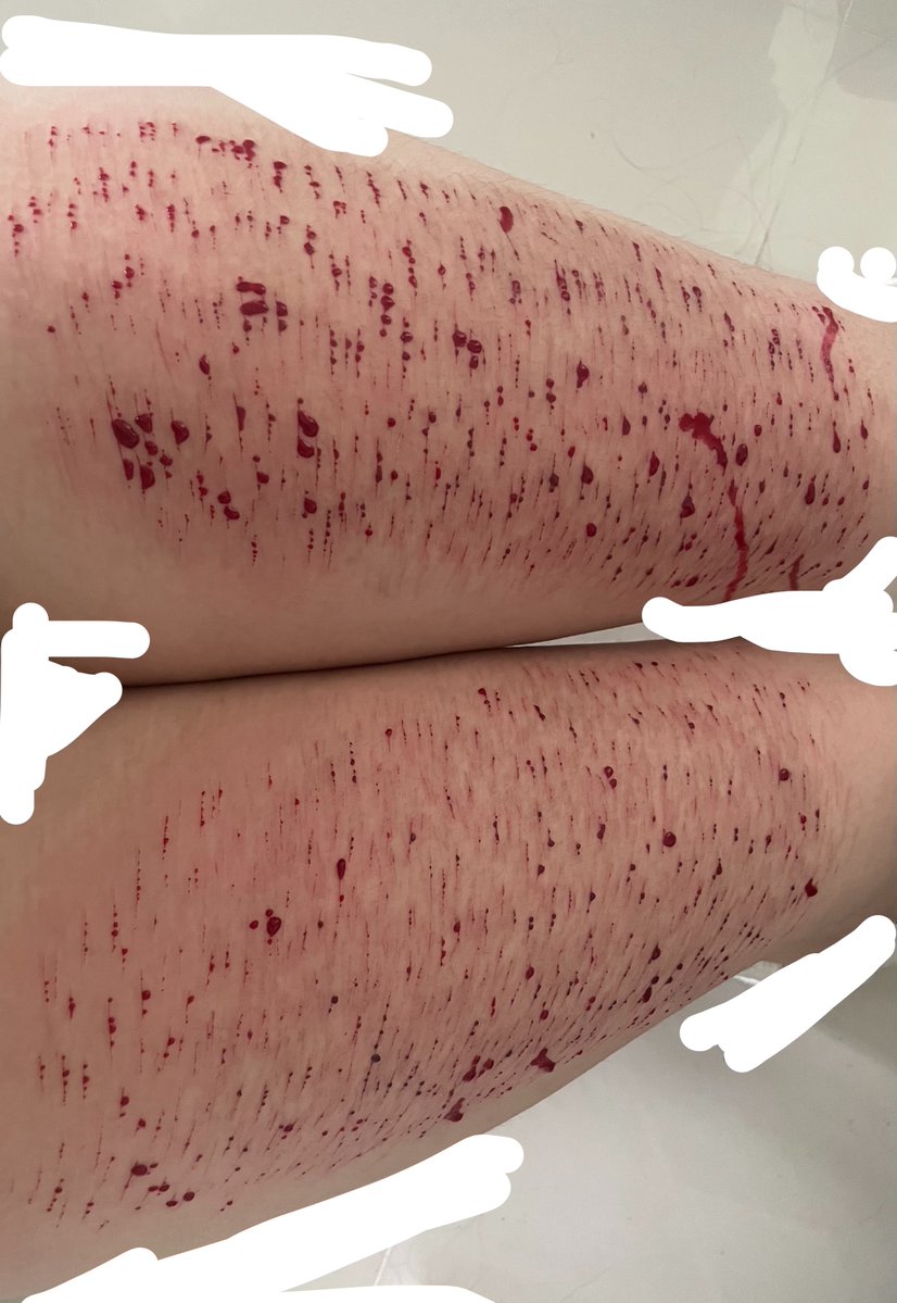 zeroL01hate's tweet photo. sfx makeup
 all fake
#sfxmakeup
#sfx
#makeup
#fake https://t.co/ShWdM34BY9