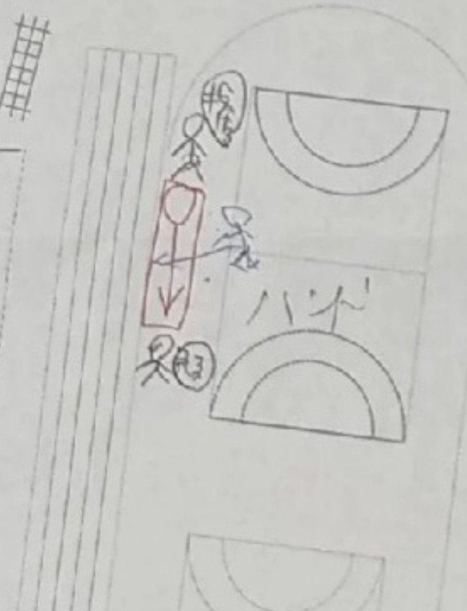 aniki_enbu's tweet photo. ハンドボールと100mトラックの間5m程の隙間でホーガン投げの練習させています。
しかも仕切りのネット未設置。

頭蓋骨陥没骨折。
意識は、血止と癲癇抑制の点滴で眠気が凄く目も虚ろ。

痛み止めが覚めた時に会話をしてる状態。

もうこれからは、TVニュースは信じないようにします。 https://t.co/2lmEoj0Ndf