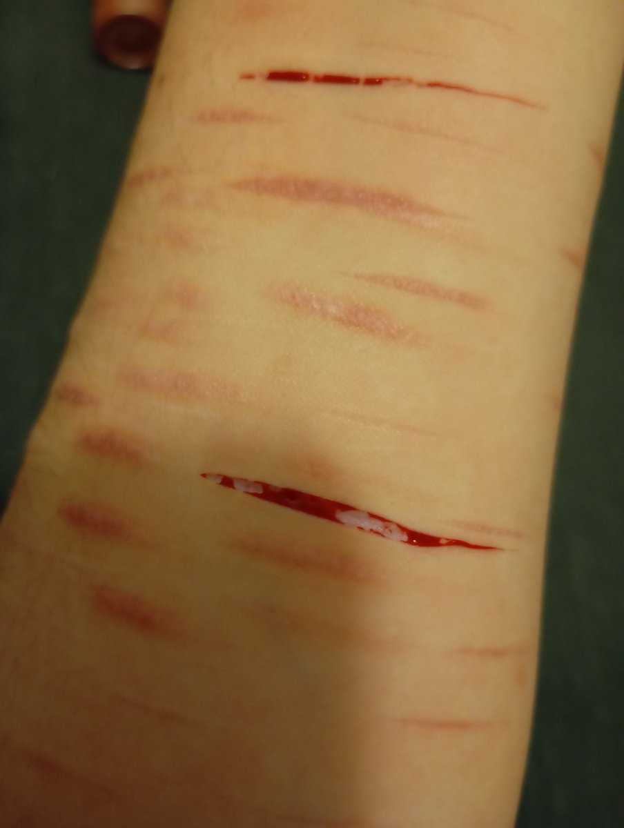 mugurelll_'s tweet photo. This styro is JUICYYY 
I still feel unvalid and I want beans. 
!! SFX MAKEUP PRACTICE!! 
!! ALL FAKE!! 
#sfxmakeup #fake #ai #shedtwt #ouchietwt https://t.co/4CWBGN7ih5
