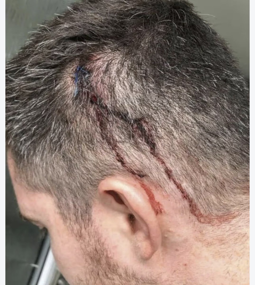 brianboru67's tweet photo. For the record !! 
Celtic never released a statement anything like that when the clubs very own physio had a bottle smashed over his head at Ibrox . 
 Desmond needs to pack his bags and go . https://t.co/EAM2JOMvBM
