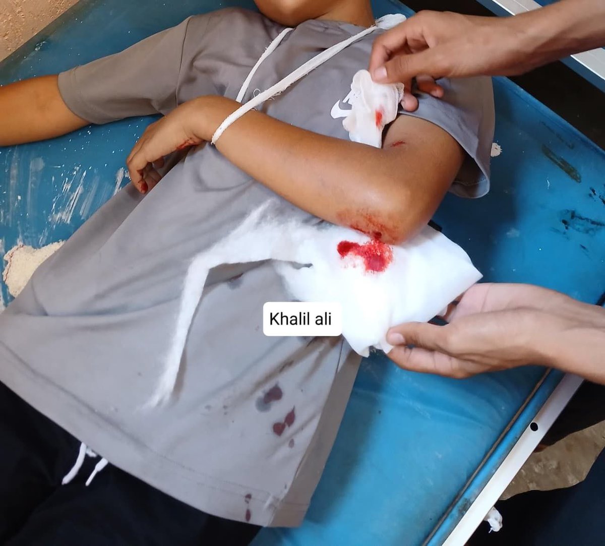 MosabAbuToha's tweet photo. Latest updates from Gaza today, October 4, 2026. (All in local time):

9:00 a.m.
A Palestinian named Saqr al-Qaisi was slaughtered and 10 others were injured in a strike on a vehicle in the Al-Hawz area of Deir al-Balah, in central Gaza.

10:53 a.m.
Four people were injured in a strike targeting a group of civilians in Beit Lahia, northern Gaza.

11:45 a.m.
Six-year-old Suha Mohammed Nasser died from injuries sustained after being shot by Israeli forces inside her displacement tent in the Wadi al-Salqa area, south of Deir al-Balah in central Gaza.

11:57 a.m.
36-year-old Muath Jamal Abu Nusaira was killed and several others were wounded after civilians were targeted near Al-Makab Street, northwest of Khan Younis.

12:37 p.m.
A child was injured by Israeli gunfire while carrying water at his place of displacement at Abdel Qader Al-Husseini School in western Khan Younis.

12:42 p.m.
Two people, including a woman, were injured by Israeli forces in the Al-Salatin area of Beit Lahia in northern Gaza.

2:50 p.m.
Israel carried out a strike on a group of civilians in the Al-Majaida neighborhood near Street 5, west of Khan Younis. Several people were injured.