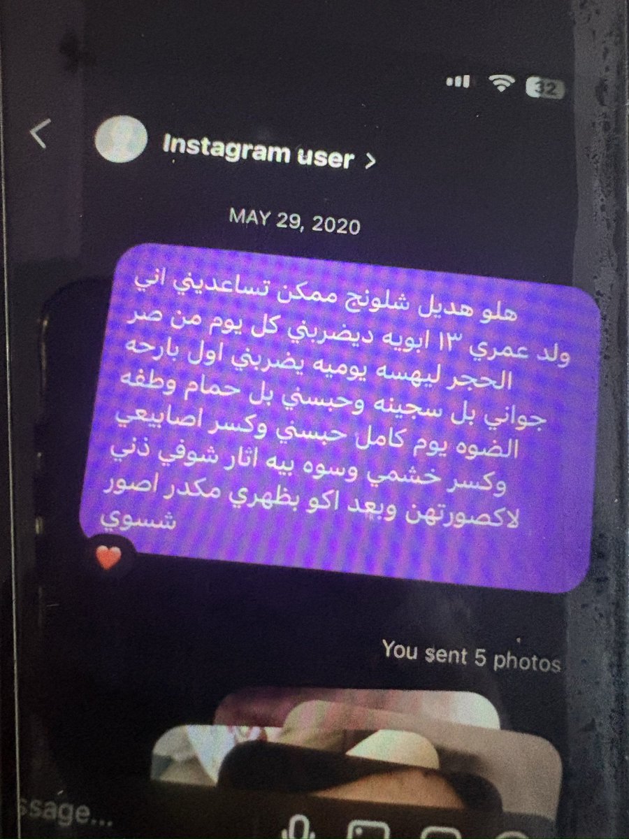 Sufi495's tweet photo. ليش چنت اطالب بتفعيل قانون العنف الاسري ؟  . تفضلوا هذا شاب عمره 19 سنة يتعرض لضرب من ابوه  من عمره 13 هذا غير چان ياخذه عند ناس يعتدون عليه ويسوي وياه اشياء قـذرة . راسل اهواي ناس واتصل بالشرطة بس ما فاد ابو چان يشوف تقريره لشرطة انو عنده مرض ذهان ويگللهم يتهجم علينا لذلك اضطر اضربه .  راسلني گالي يفيد النشر ؟ ماأعرفت شنو اجاوبه او شنو الحلول اللي انطي اياه لا قانون عنف اسري مفعل لا اكو شي لصالحنا .  اب عندا ذريعة انو الابن عندا مرض الذهان ونفس الشي يگوله لشرطة كل مرة . أحس نفسي مربوط وما أعرف شلون ممكن اساعده ! 
#تفعيل_قانون_العنف_الاسري 
#ضد_قانون_الاحوال٥