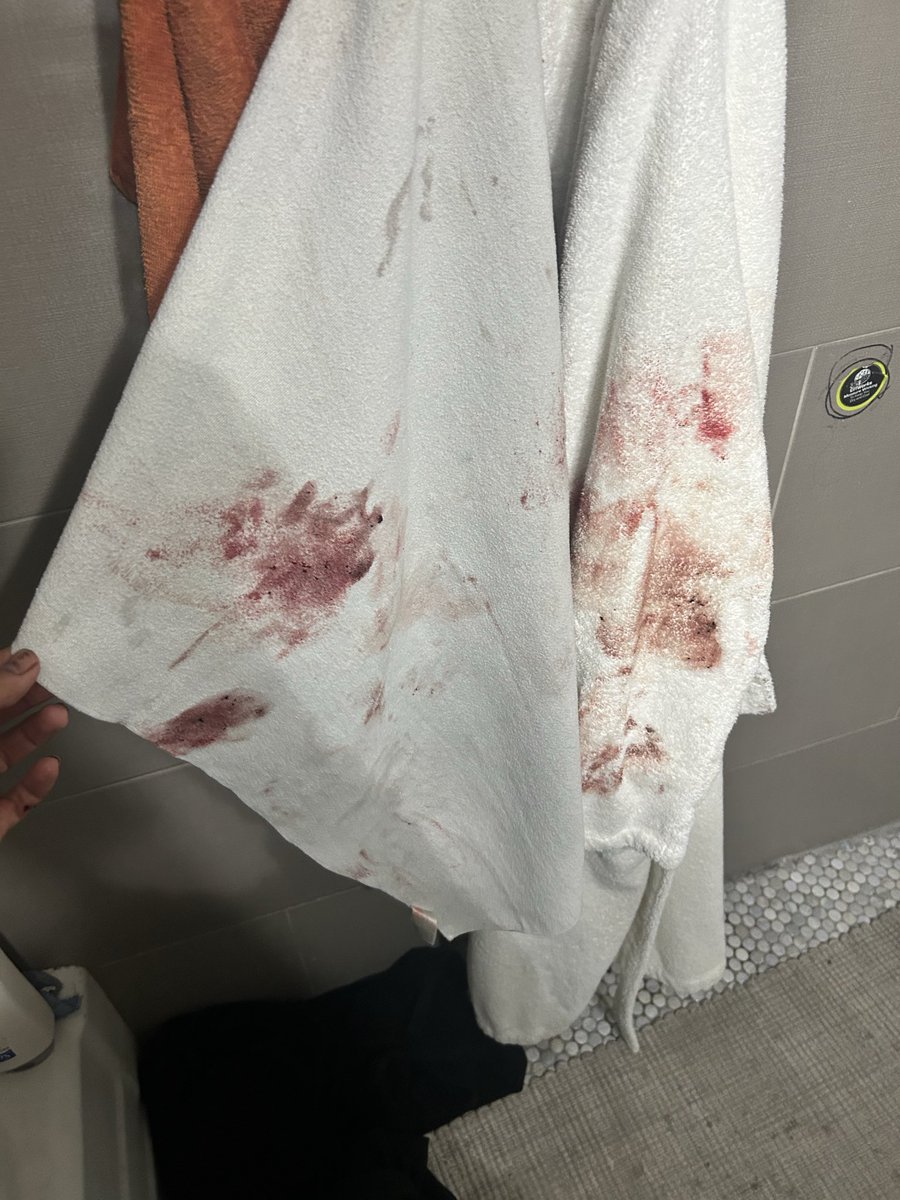 iwannahaveas14's tweet photo. #shtwt #988twt #shrtwt 

This is Fake/sfx/makeup/ai https://t.co/IugDG8JKEM