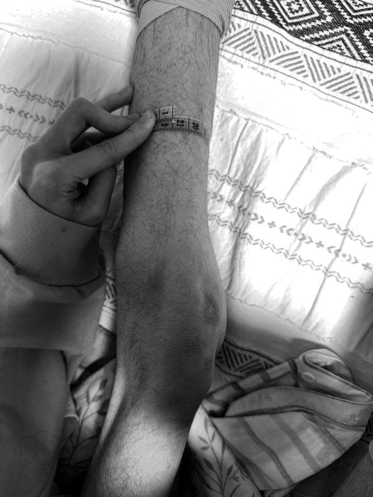 decayedwhole's tweet photo. the need to be skin and bones is spiraling out of control 
#edrtwt #deathspo #proanatwt #bonespo #thinspo #fatspo https://t.co/jv1OUsS47Y