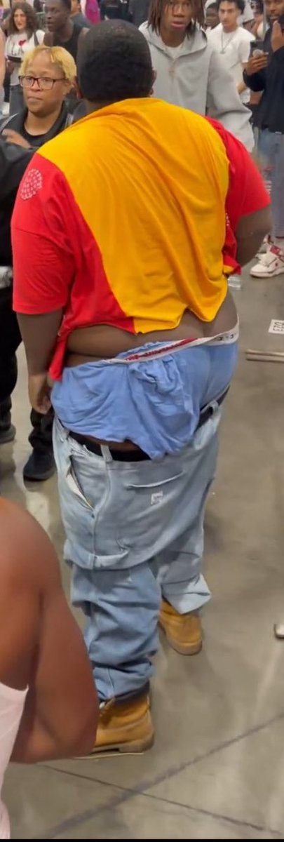 SleepyWoo_'s tweet photo. LMAOOOOO CAN SOMEONE TELL ME WHAT ANIMAL ATTACKED THIS GUY?😭😭 https://t.co/iGS6gxpPPJ