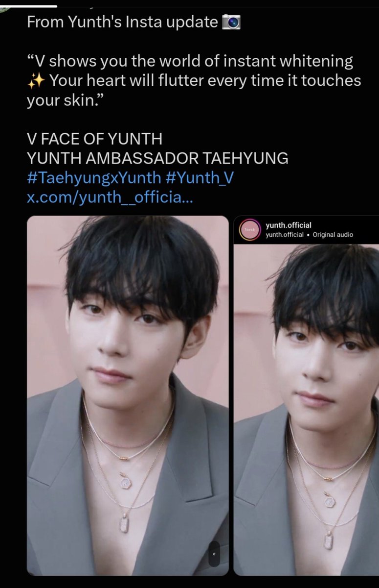 LJmtl14's tweet photo. @tetemyloveeee2 @Bangtan7_Stream It looks like your favorite is pushing the idea to his race that white skin is a privilege that can be bought with money 🥱 https://t.co/Nn6UPDcwZ8