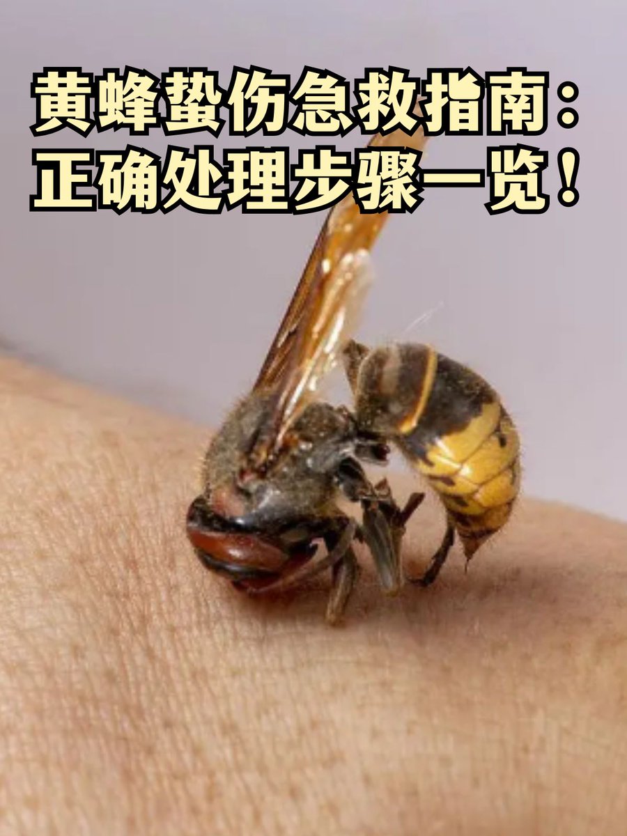 allen_berg760's tweet photo. I accidentally slipped and my thumb touched the bee, then it stung—ouch! https://t.co/xReE7O4cQR