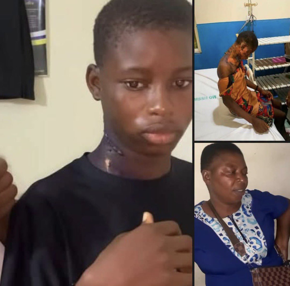 VoiceOfTheEast's tweet photo. Woman Sentenced for Pouring Hot Water on 14-Year-Old Niece in Imo

A Magistrate Court in Imo State has sentenced Rose Okon to six months in prison for assaulting her 14-year-old niece by pouring hot water on her.

The court, however, gave her the option of paying a ₦50,000 fine instead of serving the prison term.