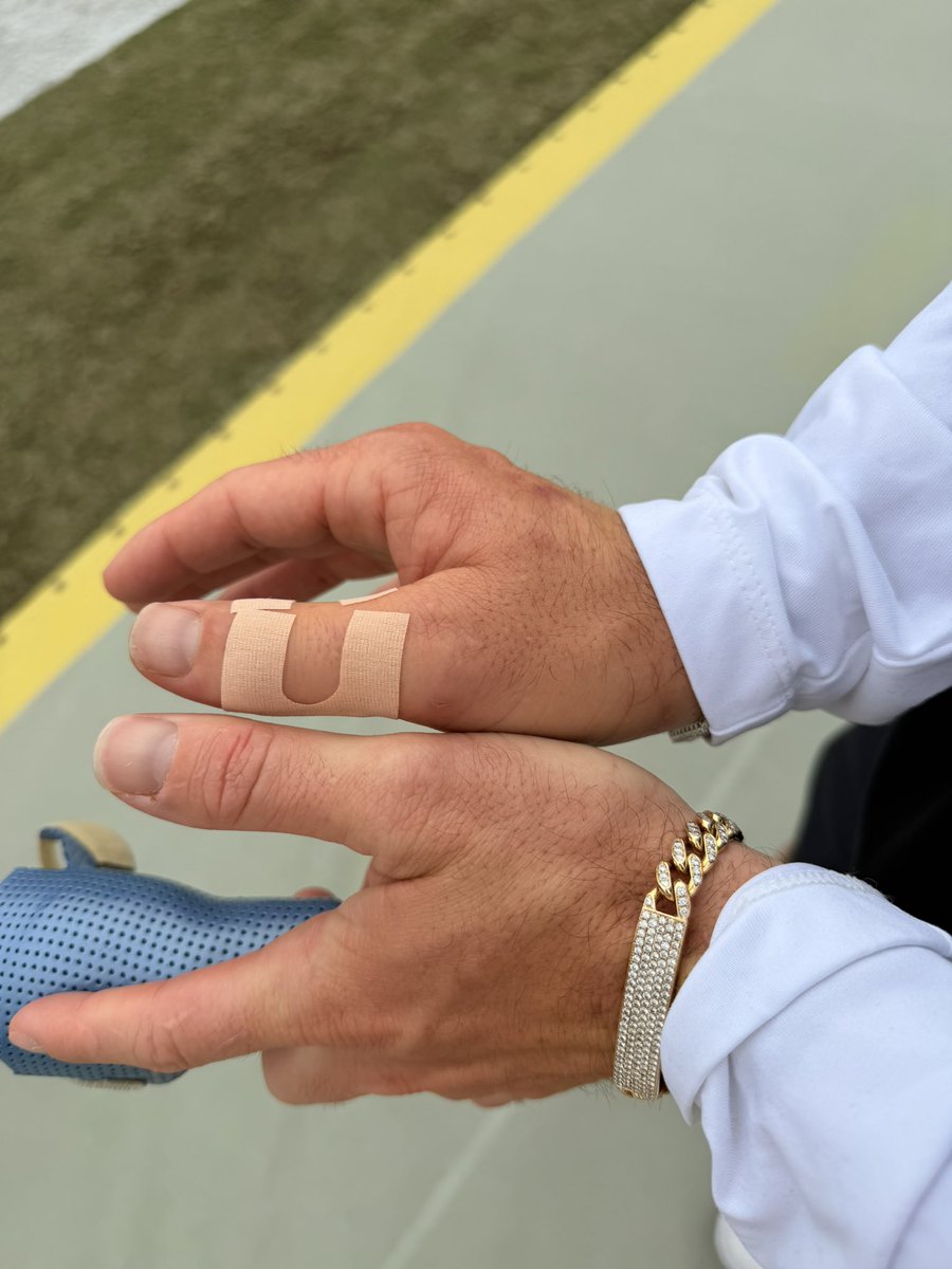 JenHale504's tweet photo. Great chat with Baker Mayfield ahead of Packers/Bucs on @NFLonFOX: expecting to get his 4 thumb stitches out tomorrow &amp; then began rehab. So far just been working to reduce swelling w/ lymphatic drainage &amp; hyperbaric chamber. Baker tells me he'll be back ahead of schedule. https://t.co/1vE7tKhgUq