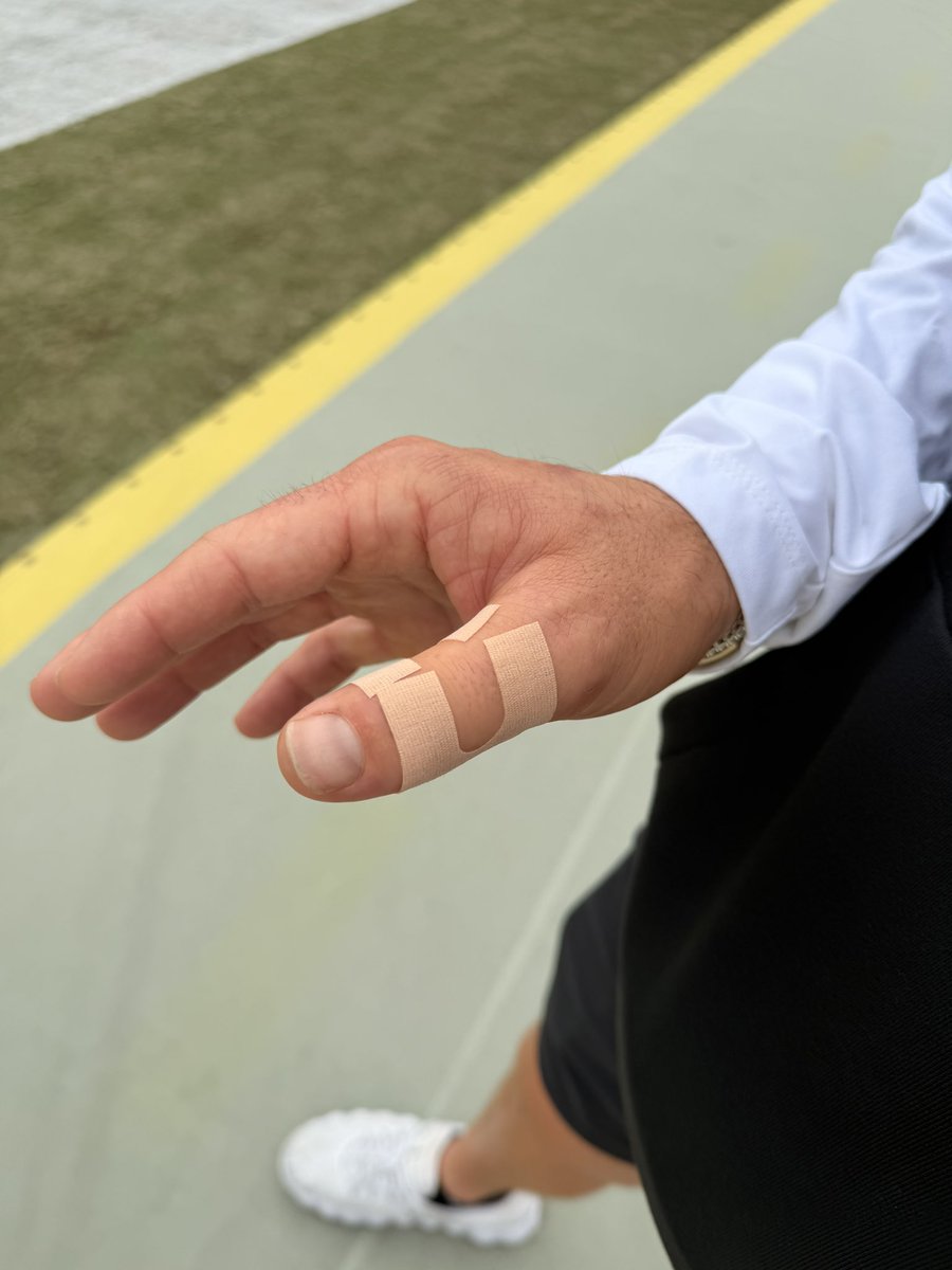 JenHale504's tweet photo. Great chat with Baker Mayfield ahead of Packers/Bucs on @NFLonFOX: expecting to get his 4 thumb stitches out tomorrow &amp; then began rehab. So far just been working to reduce swelling w/ lymphatic drainage &amp; hyperbaric chamber. Baker tells me he'll be back ahead of schedule. https://t.co/1vE7tKhgUq