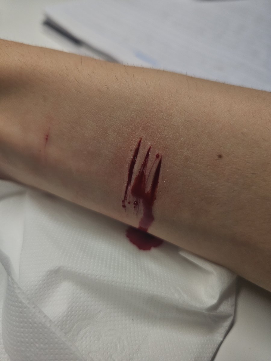 Catarine_parr's tweet photo. #sfxmakeup
Ai generated fake blood https://t.co/qY2lfJY0M0