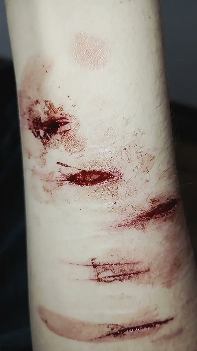 mugurelll_'s tweet photo. !! SFX MAKEUP PRACTICE !! 
!! ALL FAKE !! 
#shedtwt #sh #sfxmakeup https://t.co/DhhbAkQwOV