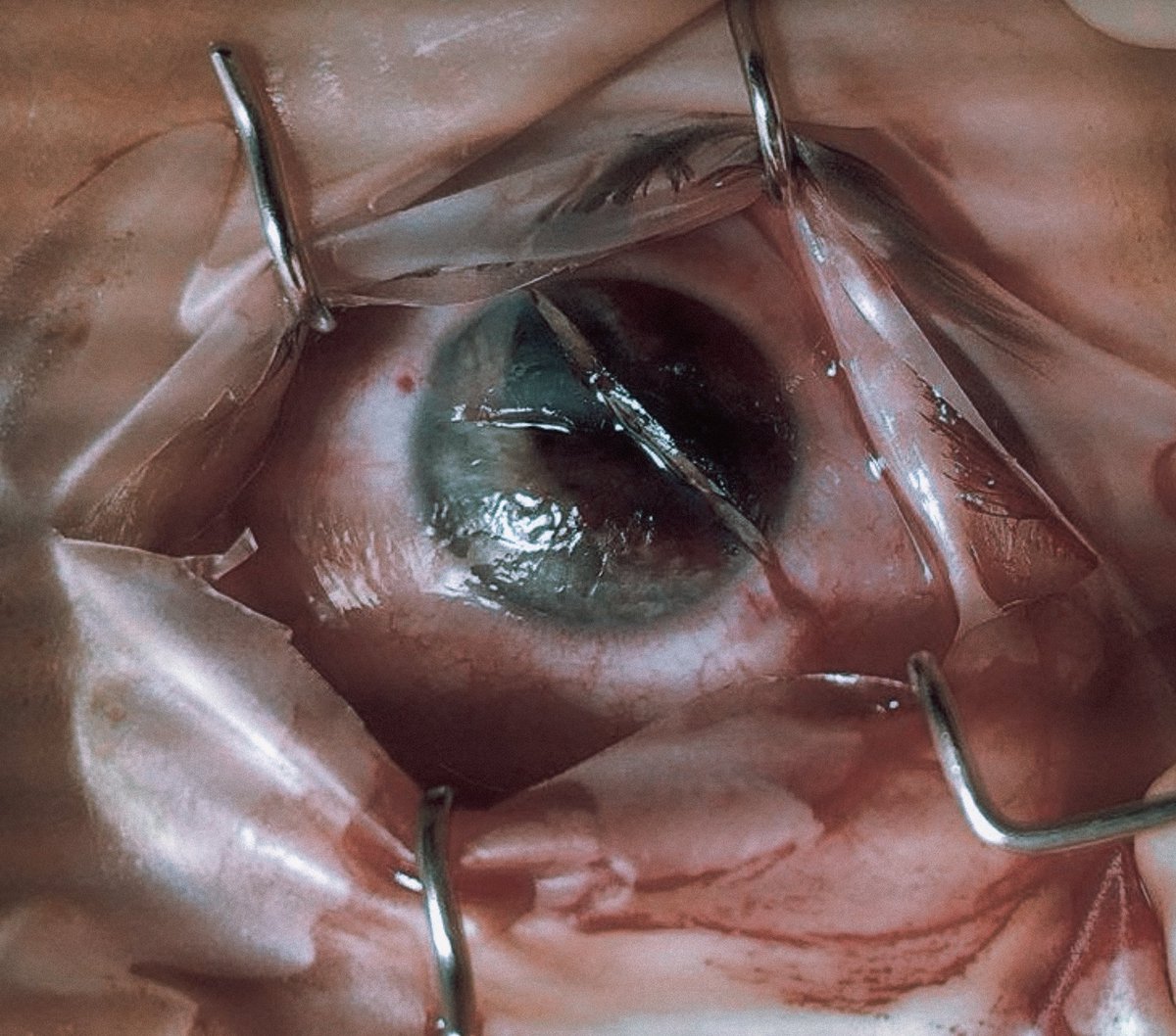 moriitician's tweet photo. eye surgery. •˚꩜｡
( horror prop / sfx art ) https://t.co/cDKJwayjgO