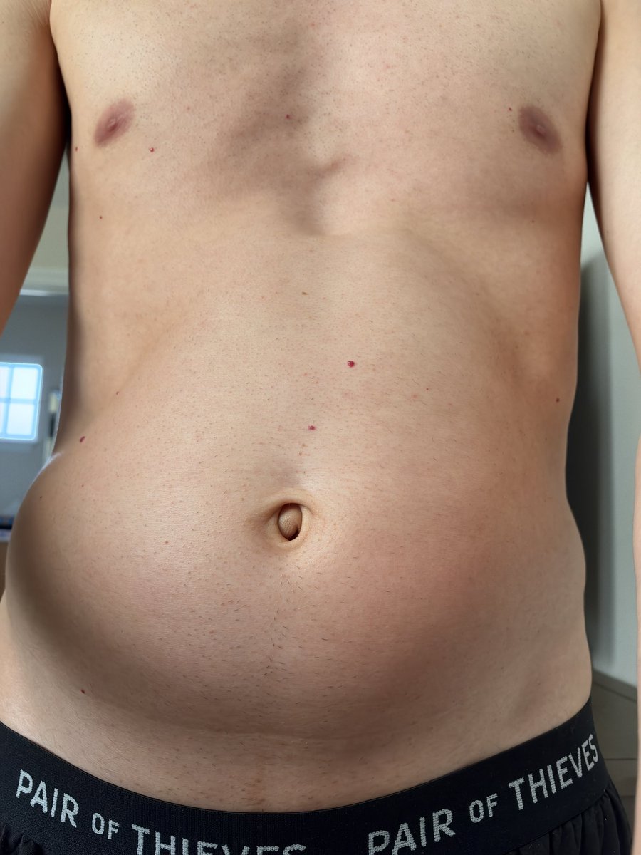 SwirlyDude's tweet photo. My belly button looks different after I gained some weight. 😲 Is this new shape ok? 👀 https://t.co/hcQWd7XqDq