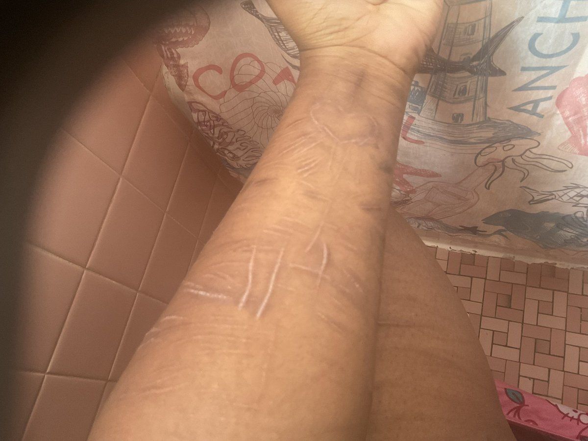 SweetPupyDreams's tweet photo. #healing so far https://t.co/CwI3lvcAPI