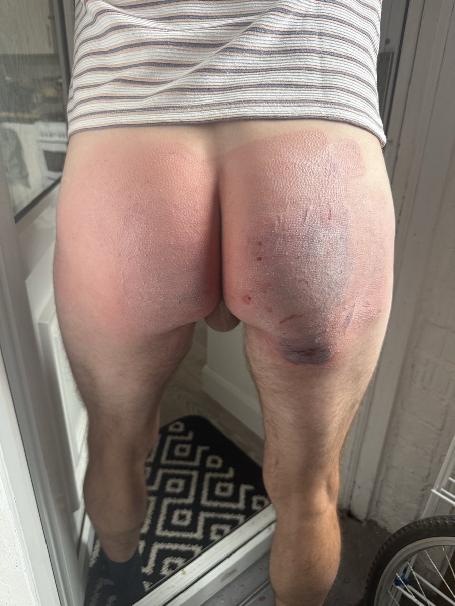 DomDaddyNE's tweet photo. Delivered a Sentenced judicial punishment to this sub
#judical #spanking #discipline https://t.co/mUgQRbfnL1