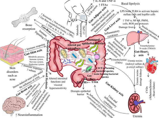 Helios_Movement's tweet photo. Healing your gut is the only thing that can improve every other aspect of your health.

Our gut is connected to multiple organs and systems, affecting their function for the better or worse every single second that passes.

This is why dysbiosis is linked to:

-Skin issues ranging from acne all the way to psoriasis

-Obesity and metabolic syndrome
-Polycystic ovary syndrome (PCOS)
-Autoimmune conditions
-Mood disorders ranging from general anxiety and depression all the way to bipolar disorders, OCD and even schizophrenia
-Alzheimer’s
-Low libido
-Kidney stones
-Low testosterone
-Thyroid disorders
-Chronic fatigue
-Cardiovascular disease
-Food intolerances
-Histamine intolerance
-And even certain types of cancer, whether that’s called pancreatic cancer, hepatocellular carcinoma, breast and even lung cancer

As Hippocrates, the father of medicine, famously said: Every disease begins in the gut.

Think about it:

-Transferring gut bacteria from depressed people to animals can induce depression-like behaviors and symptoms of mental illness overall.

-The estrobolome (specific gut bacteria) produces enzymes like β-glucuronidase that deconjugate estrogens in the intestines, allowing them to be reabsorbed into the bloodstream instead of being excreted.

So high β-glucuronidase activity which is often a result of dysbiosis, can lead to estrogen dominance, linked to conditions like endometriosis, fibroids, or breast cancer risk and so on.

-A healthy gut produces SCFAs such as butyrate and propionate.

These help regulate glucose metabolism, activate G-protein-coupled receptors such as GPR41/43 to lower blood pressure, reduce arterial inflammation, improve insulin sensitivity by enhancing GLP-1 and PYY secretion, activate receptors such as GPR41/43 and HCA2 on keratinocytes to improve mitochondrial function, enhance skin barrier proteins like filaggrin and ceramides, and support differentiation/hydration.

-Gut dysbiosis impairs nutrient absorption which can cause issues ranging from general fatigue all the way to anemia and hormonal problems. 

Also, the microbiome aids vitamin production especially when it comes to B vitamins and vitamin K.

-DAO is mainly produced by mature enterocytes (intestinal lining cells) in the small intestine and certain bacteria convert the amino acid histidine into histamine. So dysbiosis can cause and exacerbate histamine intolerance and MCAS.

This means more skin issues, headaches, migraines, anxiety, insomnia and a vicious cycle of more gut issues.

-Certain pathogenic bacteria and yeast (like Candida) produce byproducts like ammonia and acetaldehyde. If the gut barrier is permeable, these toxins enter the bloodstream and cross the blood-brain barrier.

This is of course, problematic since ammonia for example, interferes with astrocyte function. So it quite literally makes you feel dumber since it physically slows down neuronal signaling.

Acetaldehyde also inhibits PDH by binding to its coenzyme A or thiamine pyrophosphate (TPP) (acetaldehyde inactivates thiamine by binding to its active sites) sites and excess pyruvate is shunted to lactate production through lactate dehydrogenase.

-The gut houses 70% of plasma cells (antibody producers, mostly IgA-secreting in lamina propria) and harbors a major fraction of the body’s effector/memory lymphocytes exposed to antigens.

This is why dysbiosis impairs sIgA production and Treg/Th17 balance and contributes to things such as autoimmune diseases, allergies and even chronic infections.

-Dysbiosis increases the production of pro-inflammatory cytokines like IL-6 and TNF-α by activating toll-like receptor 4 (TLR4) through lipopolysaccharides (LPS) from gram-negative bacteria for example.

This can create more problems than we can count.

Low SCFAs and high LPS impair deiodinase activity (LPS inhibits type 1 deiodinase while also altering type 2), reducing active T3 levels.

Then these cytokines inhibit Leydig cell steroidogenesis in the testes, directly reducing testosterone synthesis and they also induce inhibitory phosphorylation of the insulin receptor substrate (IRS-1), preventing the normal metabolic actions of insulin and leading to decreased glucose uptake.

This also allows more dietary histamine and bacterial histamine to leak into the bloodstream, bypassing normal DAO breakdown in the gut.

These cytokines also weaken the blood-brain barrier (BBB), causing neuroinflammation.

Once in the brain, these inflammatory markers activate microglia (the brain’s immune cells), which can disrupt the growth of new brain cells and damage neural connections, a hallmark of major depressive disorder.

In animal models for example, candida-induced inflammation reduced cognitive clarity by 30%.

Besides these, when the gut is inflamed, an enzyme called IDO is activated. 

This leads to the overproduction of quinolinic acid, a neurotoxin that overstimulates NMDA receptors in the brain, contributing to many mood disorders

-In a state of dysbiosis, TJ leakage allows the entry of foreign antigens and activates the autoimmune cascade.

-Gut bacteria show immune cells such as T-regulatory cells and Th17 cells how to distinguish between pathogens and commensals.

SCFAs also influence T-regulatory cell function.

During dysbiosis, the lack of SCFAs like butyrate prevents the induction of T-regulatory cells (Tregs). Instead, the immune system overproduces Th17 cells.

These Th17 cells circulate and migrate to the skin, releasing Interleukin-17 (IL-17) and high levels of IL-17 are the hallmark of psoriasis and hidradenitis suppurativa.

Gut dysbiosis also stimulates the release of Substance P, a neuropeptide, via the vagus nerve and systemic circulation that increases the permeability of skin blood vessels and triggers mast cells to release histamine.

This is why gut issues are so frequently linked to hives (urticaria), rosacea, and eczema.

-LPS and systemic inflammation increase BBB permeability, promote microglial activation, and impair amyloid clearance.

This is one of the many reasons why dysbiosis correlates with amyloid-β and tau pathology.

-Certain bacteria convert dietary precursors into trimethylamine (TMA).

-Increased systemic inflammation elevates cytokines that suppress the hypothalamic-pituitary-gonadal (HPG) axis.

Microbes and SCFAS in the gut influence the vagus nerve.

-SCFA-producing bacteria improve mitochondrial function in skeletal muscle, reduce inflammation-driven muscle wasting, and enhance insulin sensitivity for better protein synthesis.

-Gut-derived endotoxemia raises androgens in women.

High levels of hydrogen sulfide are well-known to inhibit cytochrome c oxidase in the mitochondrial electron transport chain, thus impairing cellular respiration and ATP production.

Certain postbiotics enhance sIgA production, balance Treg/Th17 cells, and improve both innate and adaptive immunity.

The gut microbiome influences circadian rhythm genes through SCFA signaling.

Dysbiosis reduces beneficial bacterial species that activate AhR which normally protects skin barrier and reduces inflammation.

Gut bacteria produce enzymes that metabolize dietary tryptophan into aryl hydrocarbon receptor (AhR) ligands, which strengthen the intestinal barrier, dampen inflammation, and protect against colitis and certain cancers.

Specific taxa promote oxytocin release through vagal signaling and metabolite production.

The gut and its microbiome can contribute up to 30% of the body’s systemic GABA, one of the brain’s primary inhibitory neurotransmitters.

Certain gut bacteria such as Lactobacillus and Bifidobacterium species, synthesize or influence GABA production.

So dysbiosis reduces this microbial contribution, which can heighten anxiety, insomnia, and seizure susceptibility while disrupting the gut-brain axis feedback loop.

Dysbiosis shifts profiles in bile acids which affects FXR/TGR5 signaling and lipid metabolism in the skin.

It changes primary-to-secondary bile acid conversion, affecting lipid metabolism, FXR signaling, and inflammation overall.

And all these are of course, just the tip of the iceberg.

So your gut influences your skin, energy, inflammation, and even your brain.

Even if you do not struggle with the typical issues such as bloating, constipation, gas, IBS, GERD, ulcers and so on, it’s unlikely for you to have a chronic health issue and for your gut health to not be one of the primary drivers.

Overall, if you want to improve an aspect of your health, healing your gut is something non-negligible and you can rarely improve a health issue while your gut is in a compromised state, no matter how hard you try.

But the problem is that most gut health advice is severely outdated or flat-out wrong.

After all, more people than ever struggle with gut issues and seem to be unable to resolve them year after year.

We’ve reached a point where people need 10 supplements or 10 medications just to poop and not have acid reflux at ages as young as 25.

That’s not normal.

We even have parents giving their 2-year-old kids high-dose fibre supplements with artificial sweeteners and food colourings without realising the amount of problems they are creating.

But who can blame them?

If you go to the most popular forums, sites and so on, you will see “qualified professionals” giving the worstworst advice possible.

Tips such as: “The first steps I recommend as a nutritionist are to eat more fibre every day. This includes oats, beans, lentils, fruit, vegetables, chia seeds, and whole grains.......” are very common yet they rarely work (in the case they don’t make the issue/s worse).

For millions of people, similar advice turns mild bloating into full-blown SIBO.

Or on the flipside, you have these over-restrictive diets that end up being corrosive to your own intestines, overwhelming the liver and even degrading the mucous layer.

So most people who try to heal their digestion start in the wrong place!

Overall, there are a LOT of misconceptions surrounding this topic and a lot of the popular strategies can actually make issues severely worse.

But the numbers don’t lie.

We’ve reached a point where roughly 40% of the world’s population suffers from chronic functional gastrointestinal disorders despite the amount of available interventions.

The solution to this is to understand how the digestive system works and identify the root causes of your specific issues.

This is where this https://t.co/Cd7gD7jJIz might be able to help you.

Here’s a fraction of the topics that are covered:

-Exactly how your digestion works

-The neglected mechanisms that often lead to dysbiosis

-The real tests you can take to identify the root cause of your issues faster (or if you can’t access them, how to properly interpret the symptoms you are experiencing)

-The best supplements and peptides for each gut issue to avoid making some quite expensive mistakes (plus how and when to use them, dosing protocols, interactions with other medications or supplements and which ones to avoid in general).

Because let’s face it, this is a big problem.

-The exact protective mechanisms of pathogens and how to bypass each one efficiently.

-The root causes of the most common gut issues such as general bloating and constipation all the way to SIBO, IBS, H.Pylori and candida albicans and how to approach them

-What almost everyone misses when it comes to biofilms and the protection mechanisms of certain opportunistic microbes

-Lifestyle factors that affect the state of your gut

-The most common mistakes a lot of people make when trying to resolve gut issues

-How co-existing conditions that are left unaddressed could be the root causes of your digestive discomfort and what to do about them

-Exactly what to eat based on your current state and goals

-How to rebuild your gut microbiome after following over restrictive diets and antibiotics

-Protective meassures you can take while consuming antibiotics

-60+ detailed meal plans (that actually taste good and utilize food combinations that won’t only improve the state of your gut but multiple aspects of your health)

-The key differences when it comes to nutrients for each issue

-How the usage of certain medications can trigger gut issues and what to do about it

-The one nutrient that, when left unregulated, can ruin your gut health

-The real genetic factors that could be influencing your gut health

-The two neglected organs of the digestive system that could be holding the keys to better digestion

-Key differences between men and women

-Exactly how hormones and neurotransmitters affect your digestive system and how to restore balance

-Why most plans handle die-offs very wrong and most side effects are actually a sign that you are doing more harm than good

-What toxins could be the chronic drivers of your digestive distress and how to properly get rid of them

-Free interventions you can use for better digestive health

-How to really deal with parasites

-The most neglected, yet proven for years, mechanism for hijacking biofilms that everyone neglects

-How to prevent post-infectious changes in the microbiome

-The set of daily habits most people have been told harm their gut health, when in reality, can be quite therapeutic (plus the daily habits a lot of people follow that actually ruin their gut health)

So it will give you the knowledge needed to take control back over your gut health instead of wasting time and money on the wrong things.

Here's the link one more time: https://t.co/Cd7gD7jJIz

More than 1000 people have already used it.

-George