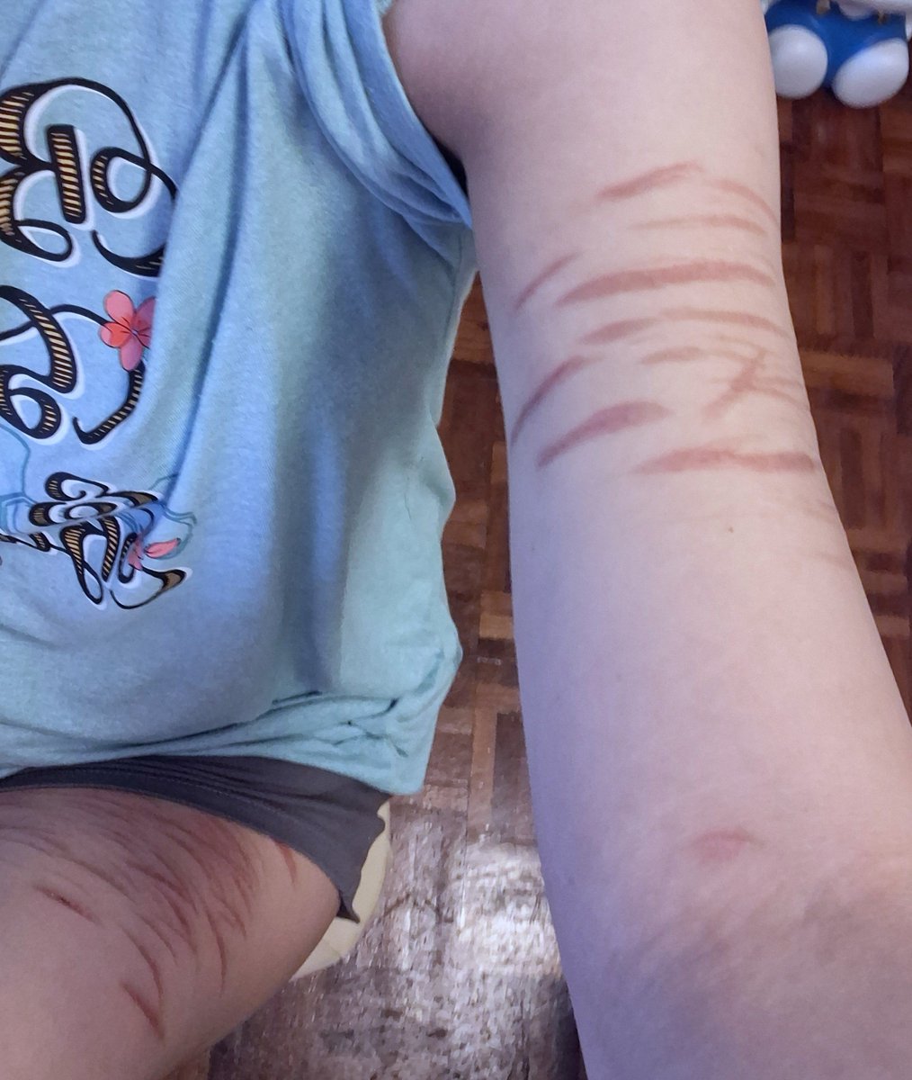erio4o's tweet photo. 討厭被性化/被物化。

//SFX Make up... The scars are all fake.// "Sxars are Fake!!!"// Never encourage for sh!!!// orz https://t.co/xyDqlEZi5B